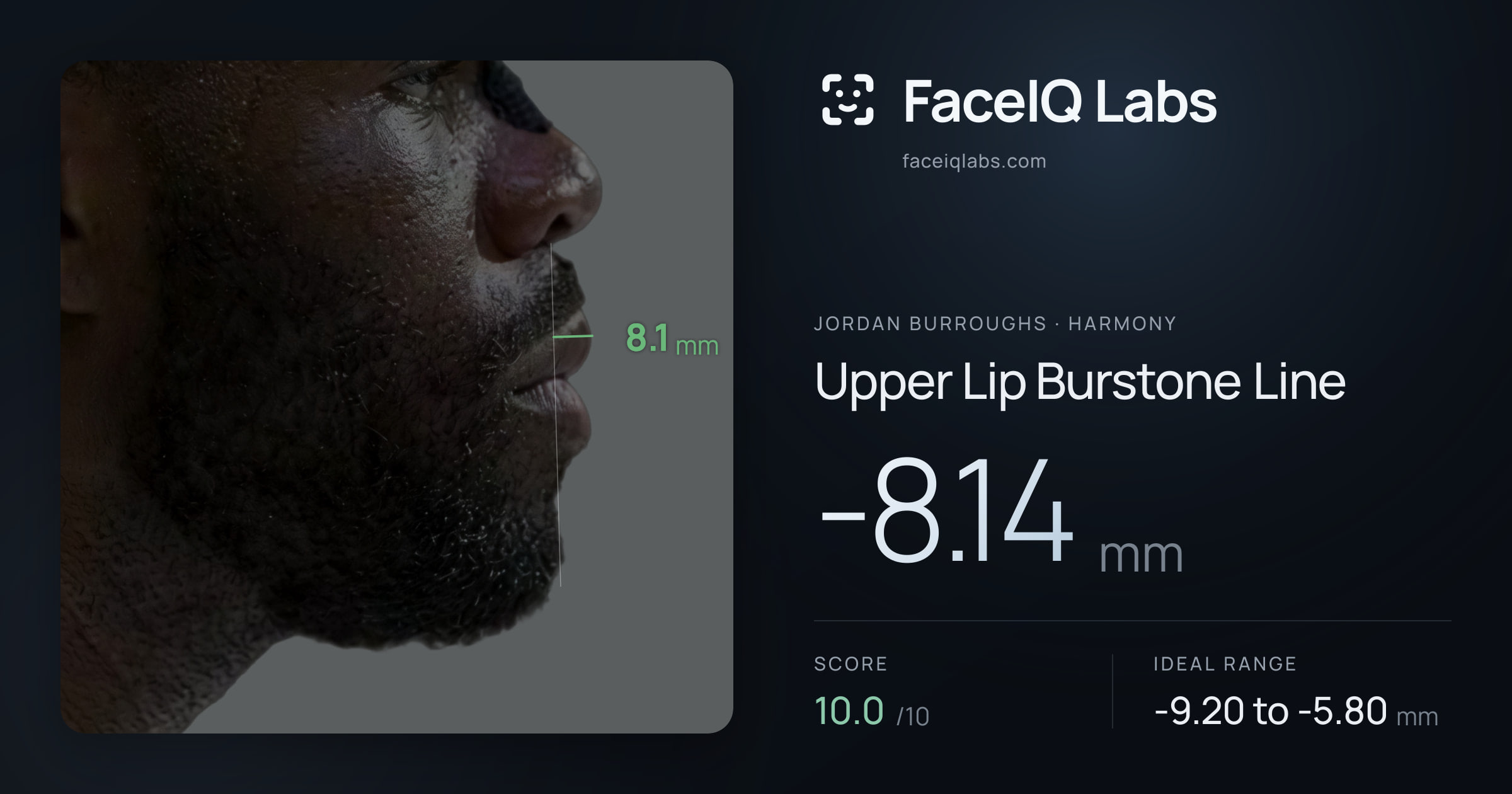 Jordan Burroughs Upper Lip Burstone Line: -8.14mm, drawn on the photo
