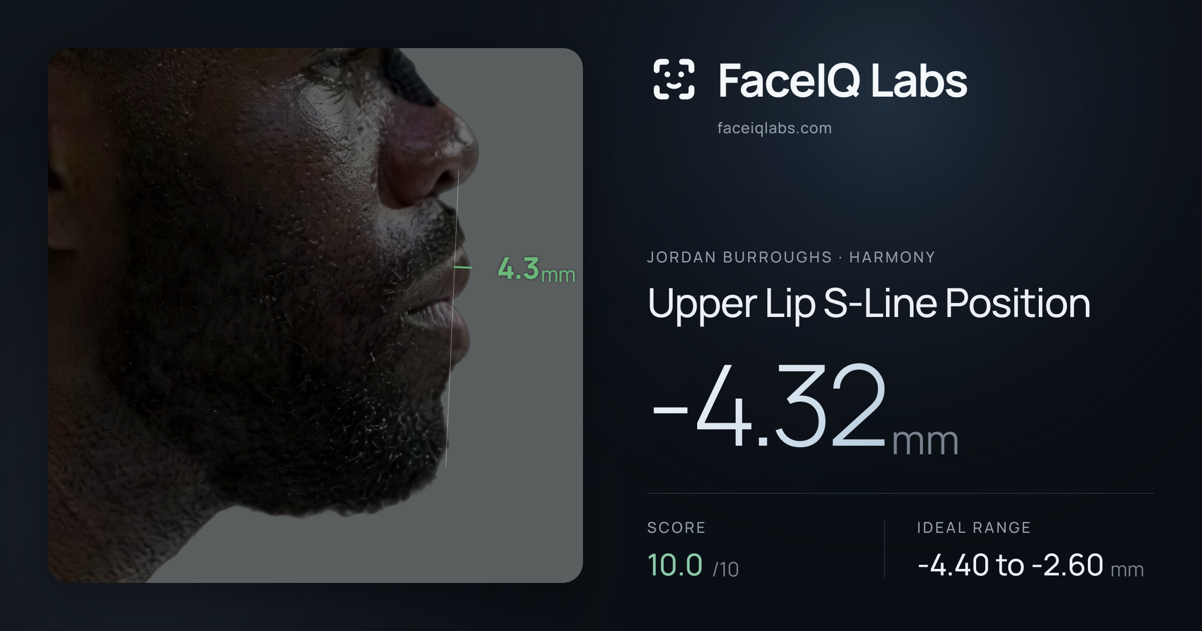 Jordan Burroughs Upper Lip S-Line Position: -4.32mm, drawn on the photo