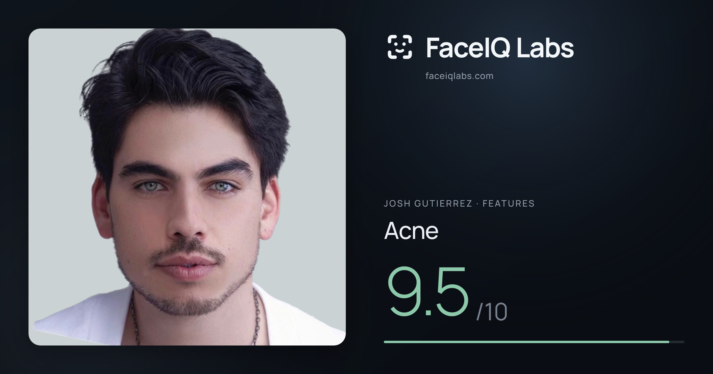Josh Gutierrez Acne: 9.5/10, drawn on the photo