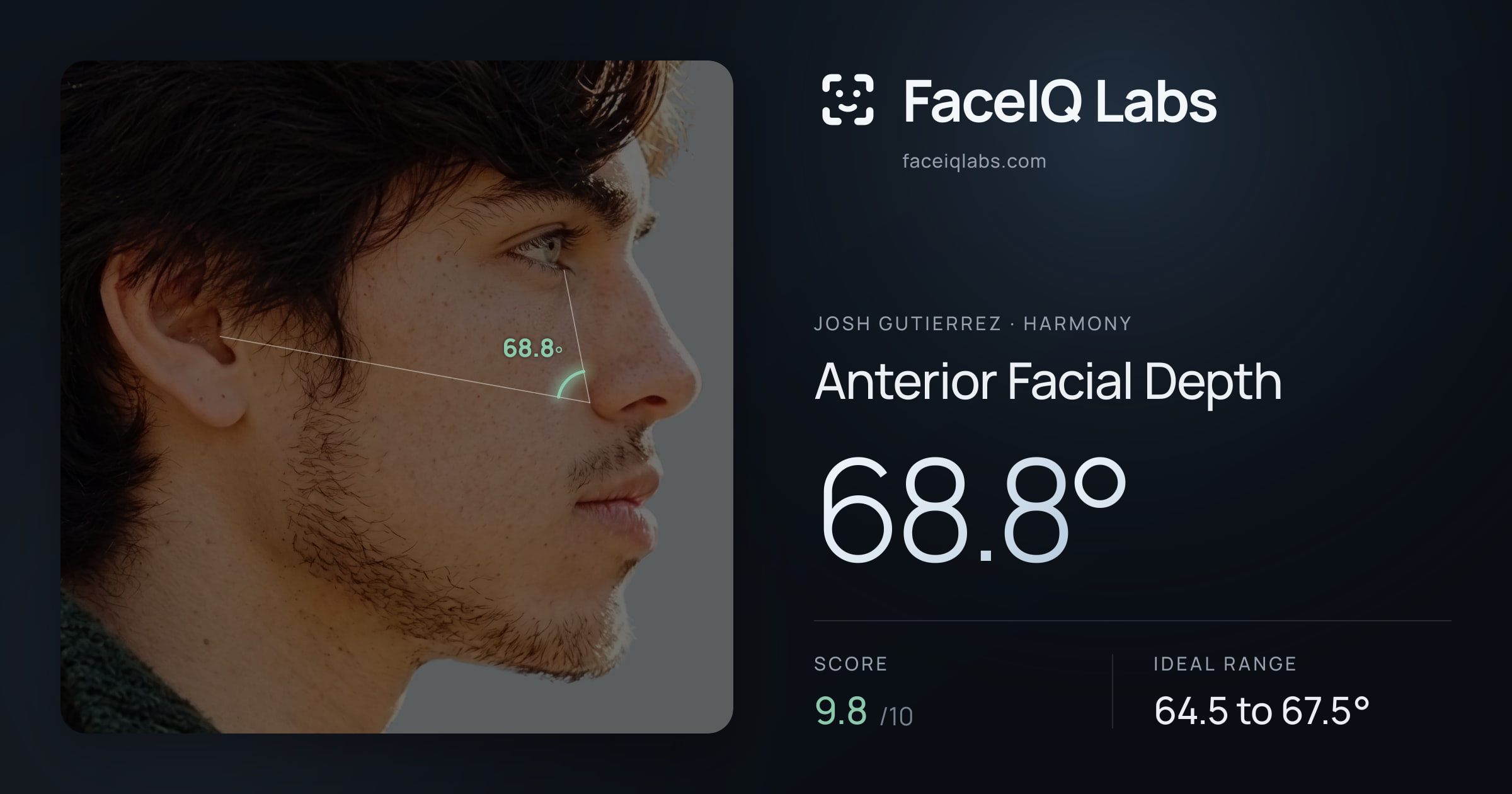 Josh Gutierrez Anterior Facial Depth: 68.8°, drawn on the photo