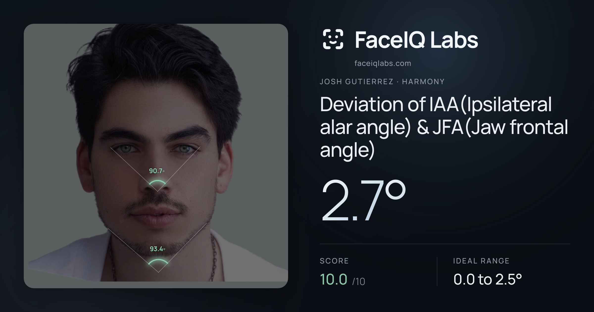 Josh Gutierrez Deviation of IAA(Ipsilateral alar angle) & JFA(Jaw frontal angle): 2.7°, drawn on the photo
