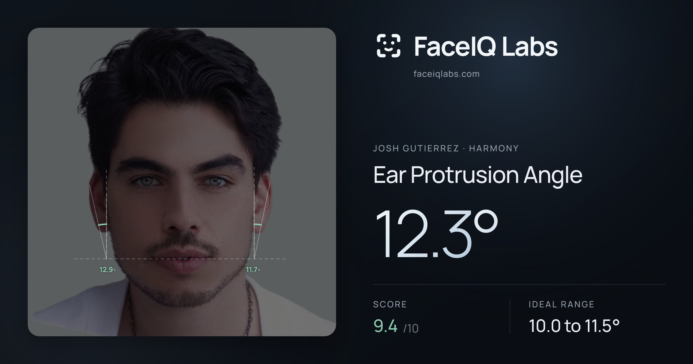 Josh Gutierrez Ear Protrusion Angle: 12.3°, drawn on the photo