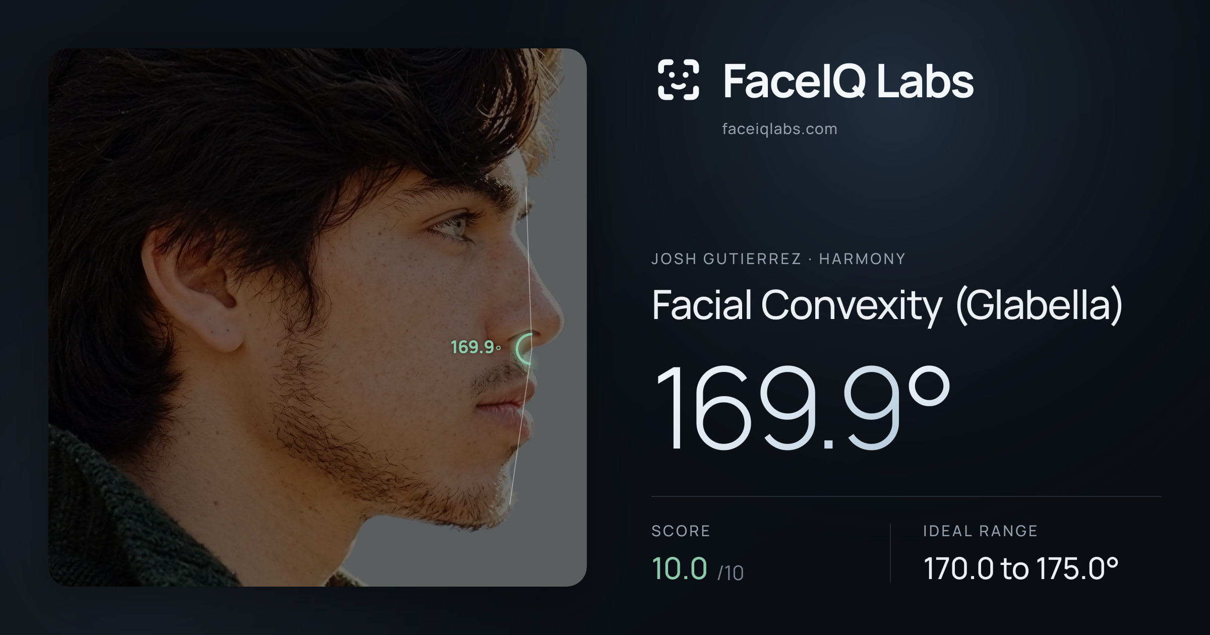 Josh Gutierrez Facial Convexity (Glabella): 169.9°, drawn on the photo
