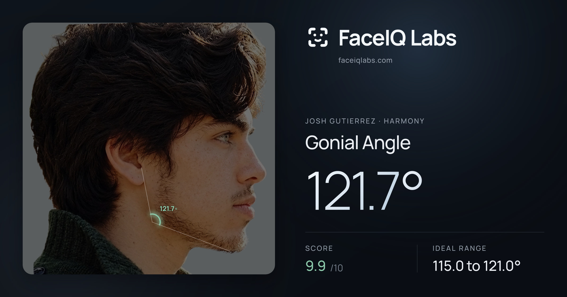 Josh Gutierrez Gonial Angle: 121.7°, drawn on the photo