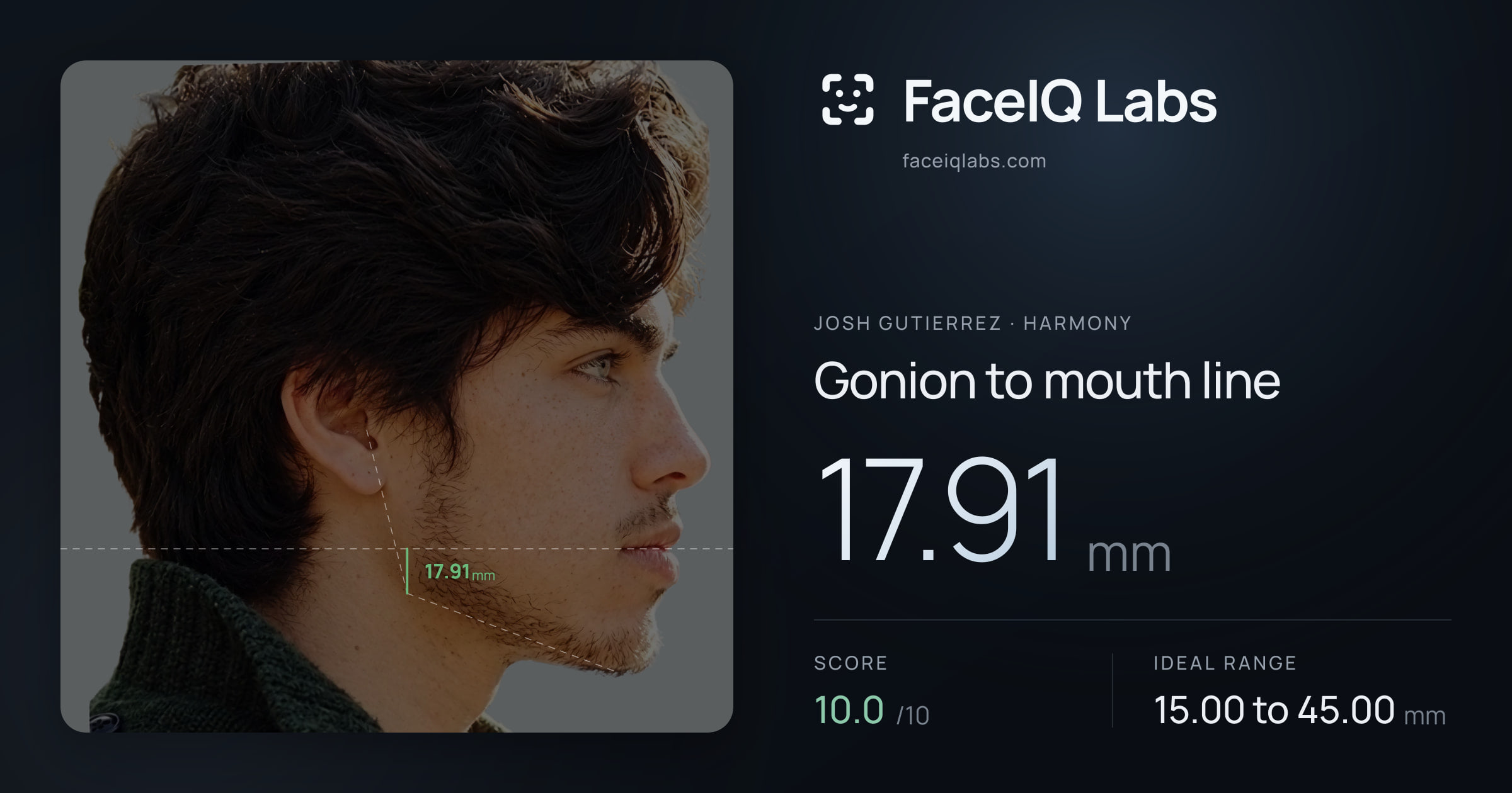 Josh Gutierrez Gonion to mouth line: 17.91mm, drawn on the photo