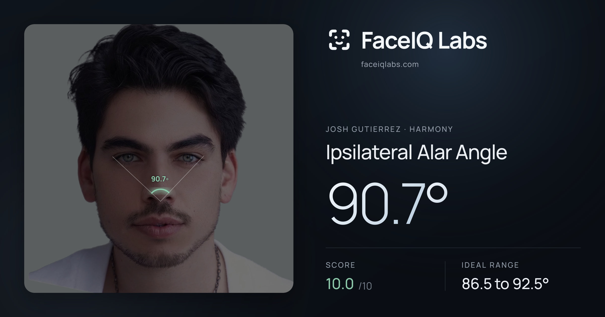 Josh Gutierrez Ipsilateral Alar Angle: 90.7°, drawn on the photo
