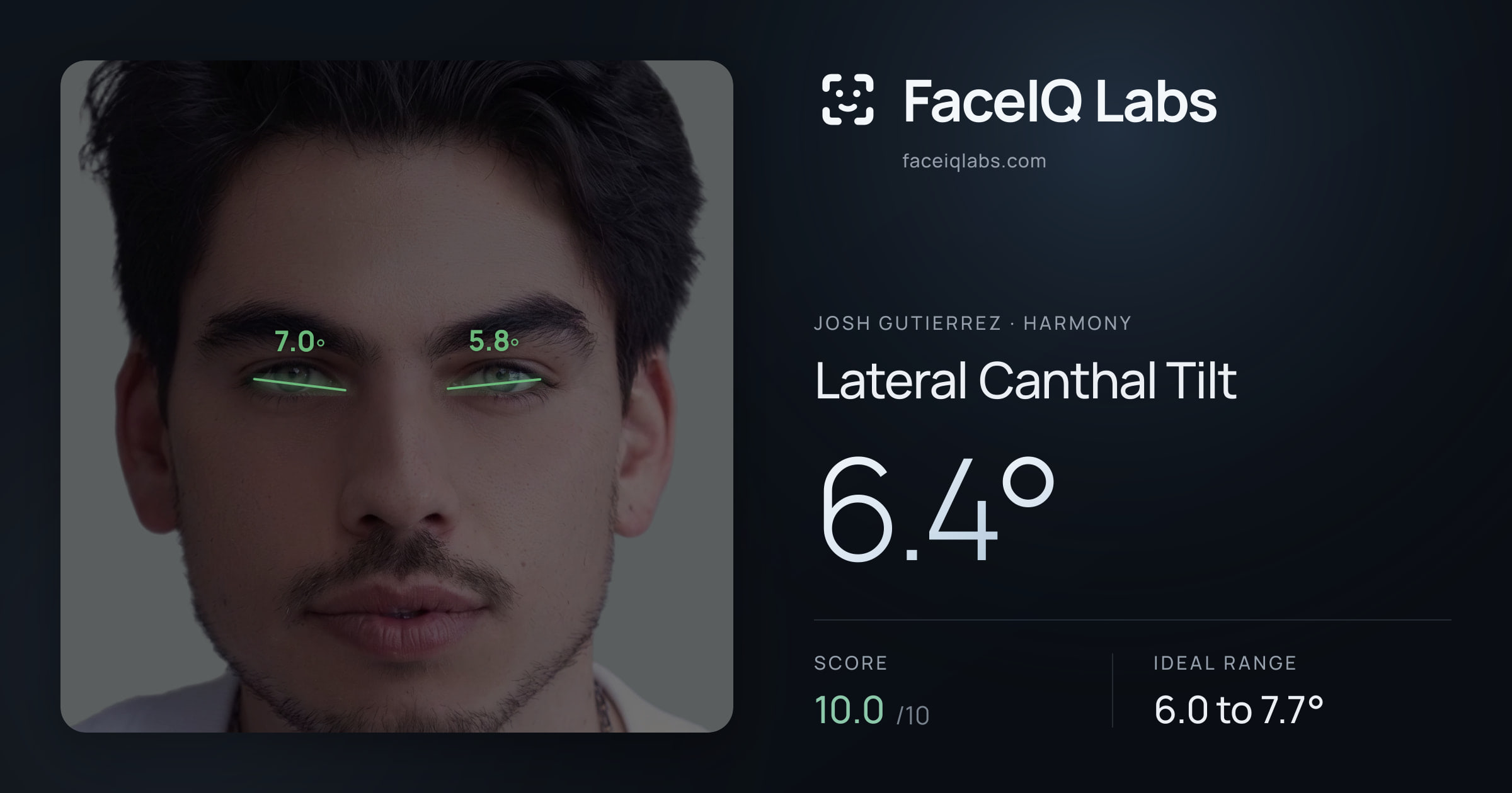 Josh Gutierrez Lateral Canthal Tilt: 6.4°, drawn on the photo