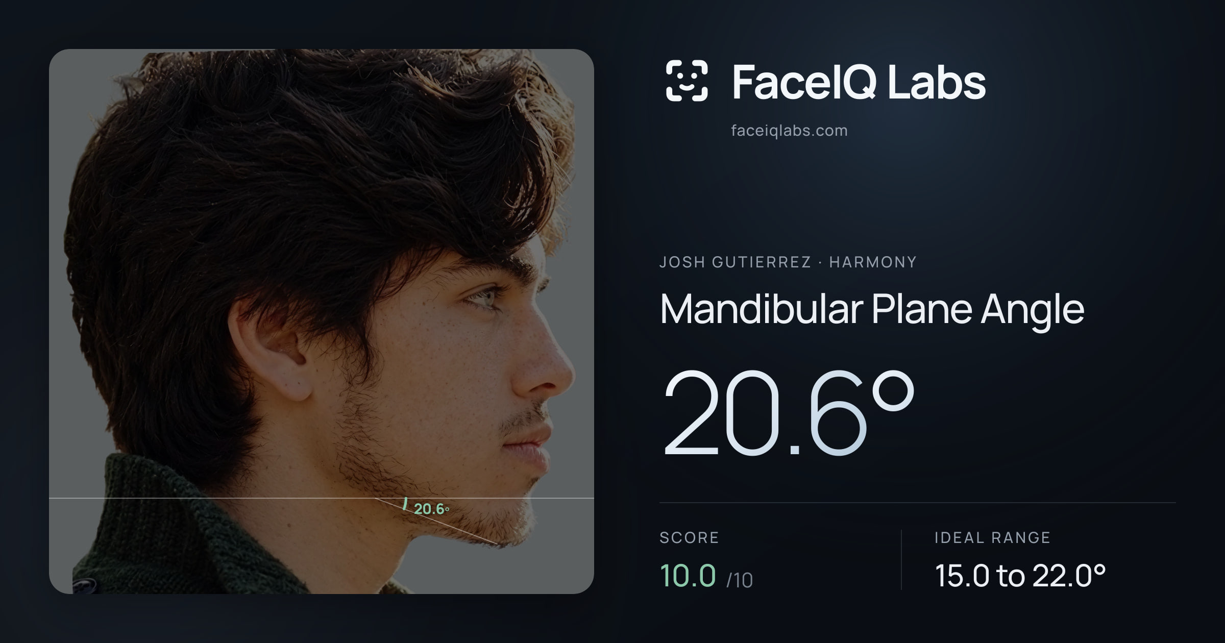 Josh Gutierrez Mandibular Plane Angle: 20.6°, drawn on the photo