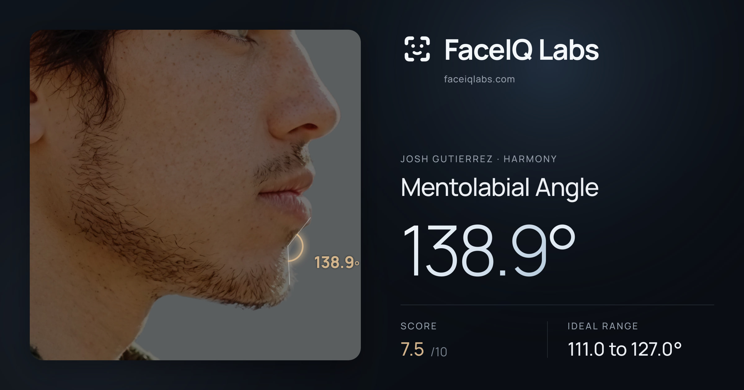 Josh Gutierrez Mentolabial Angle: 138.9°, drawn on the photo