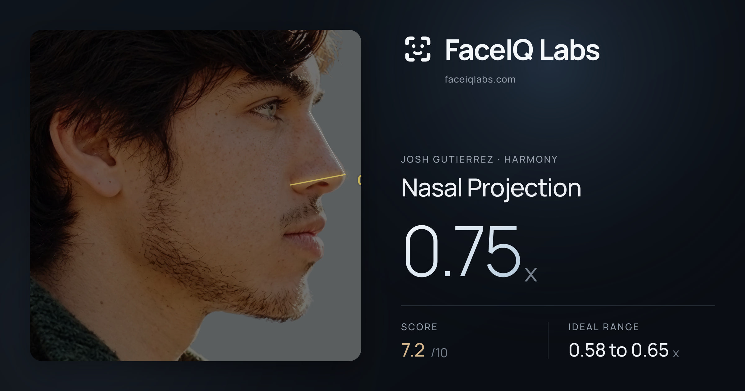 Josh Gutierrez Nasal Projection: 0.75x, drawn on the photo
