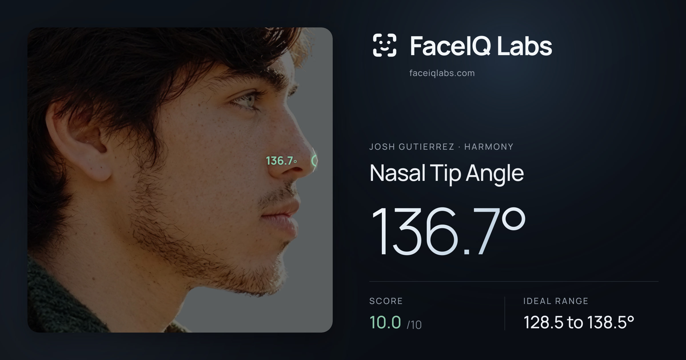 Josh Gutierrez Nasal Tip Angle: 136.7°, drawn on the photo