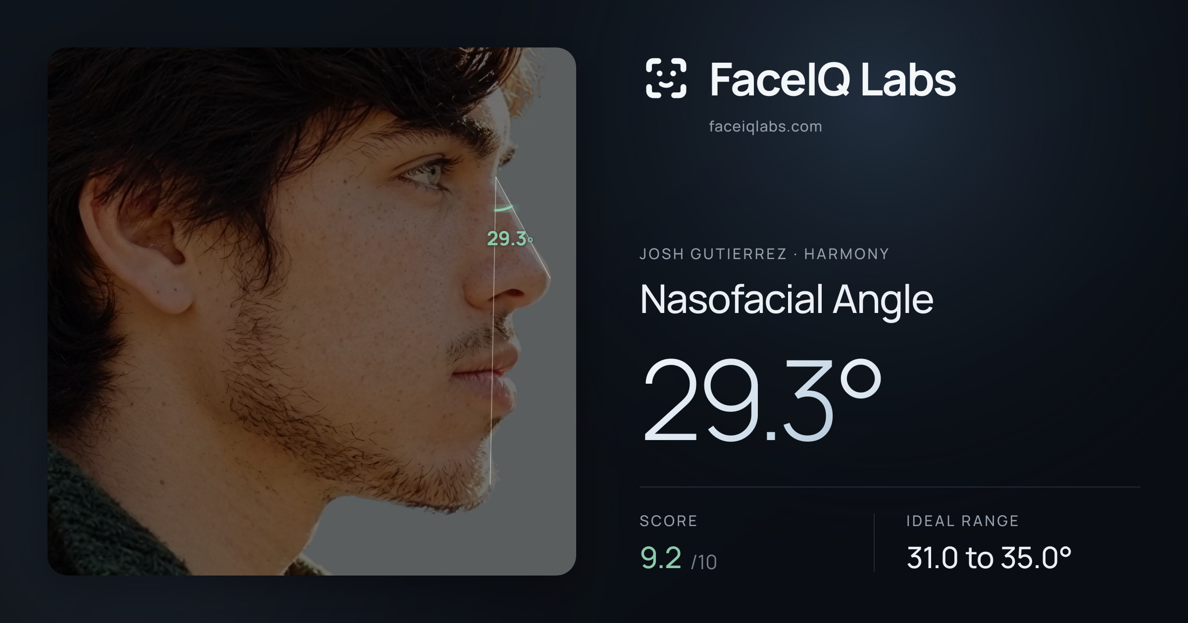 Josh Gutierrez Nasofacial Angle: 29.3°, drawn on the photo