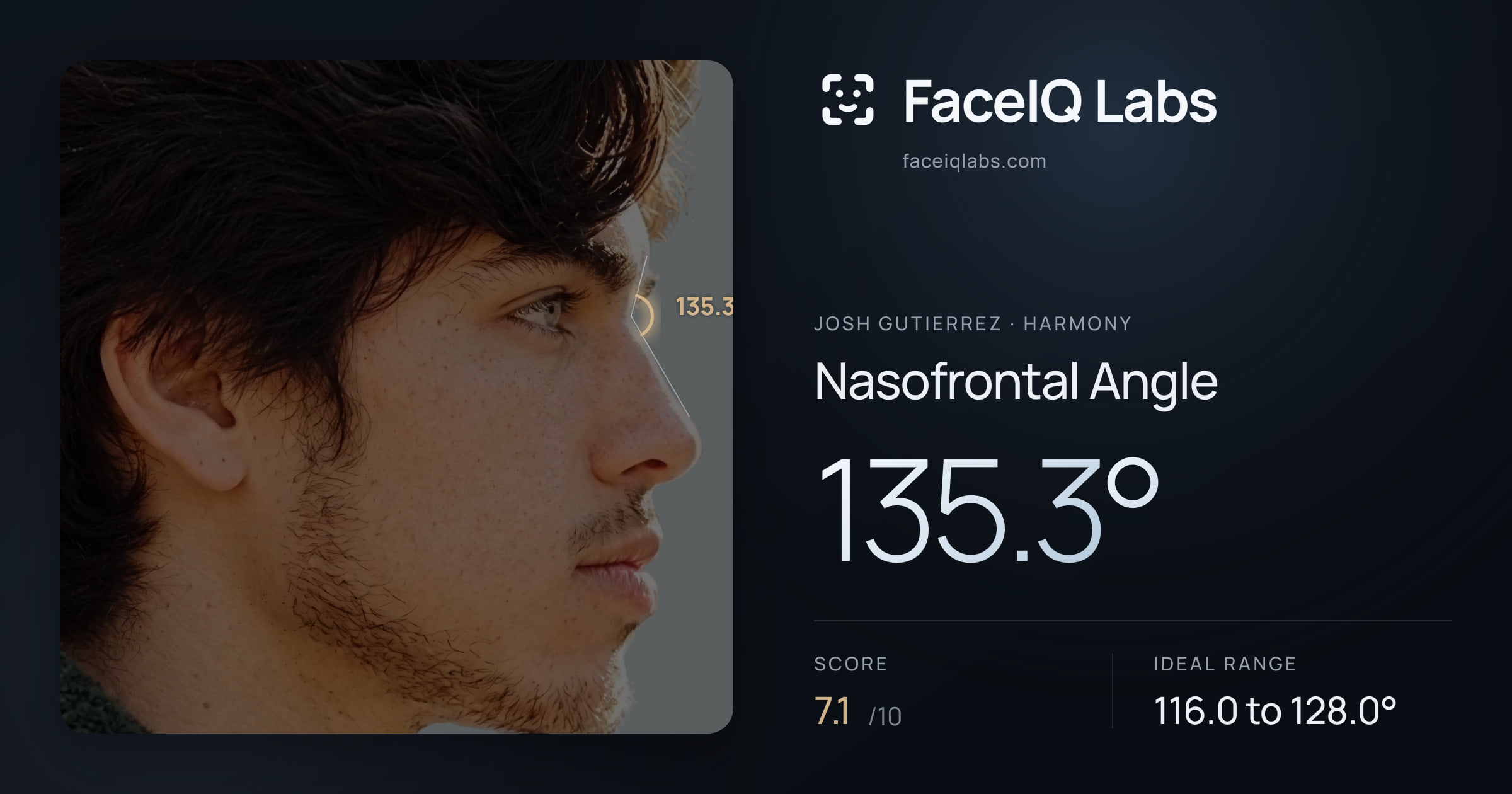 Josh Gutierrez Nasofrontal Angle: 135.3°, drawn on the photo