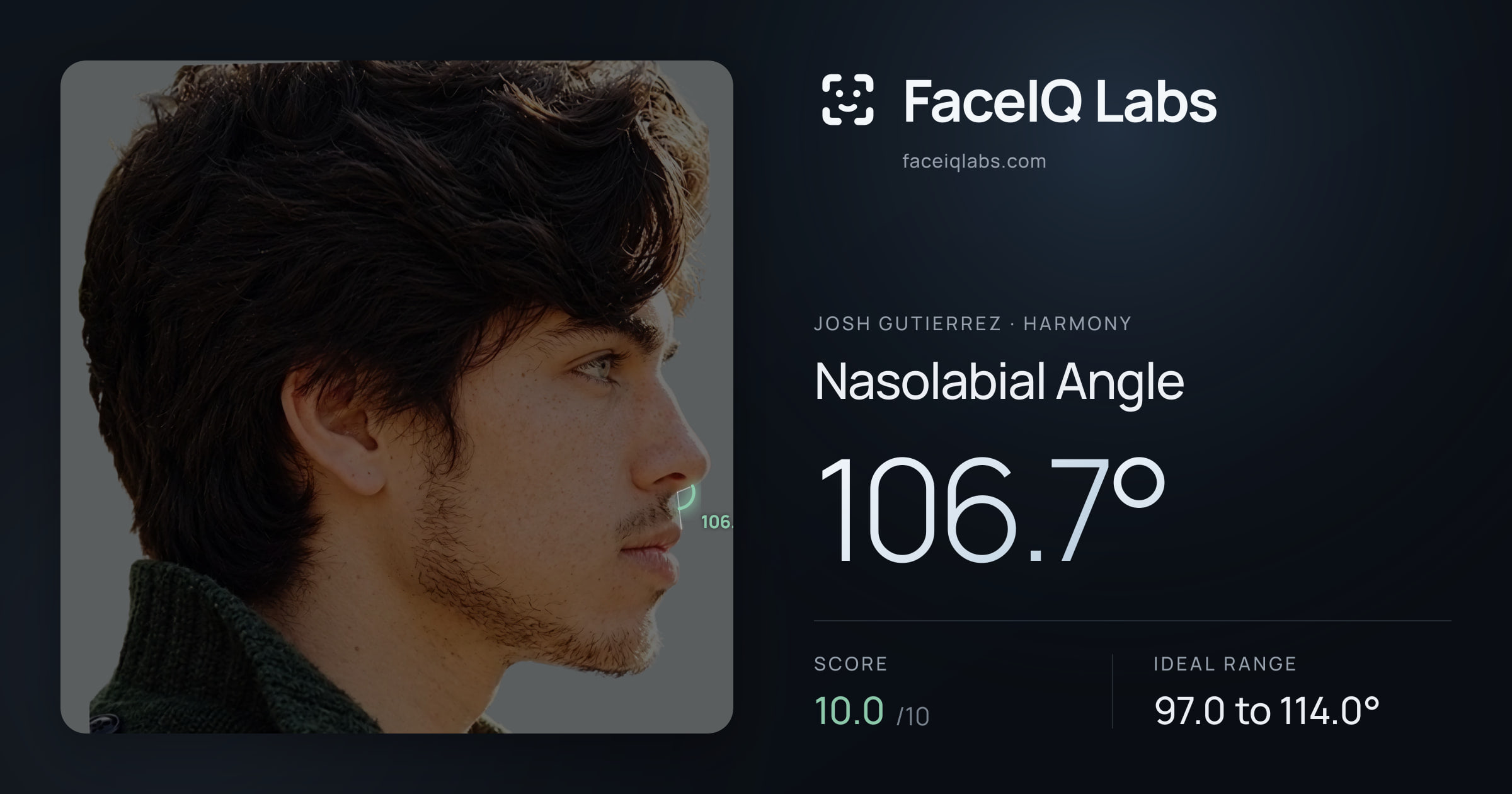 Josh Gutierrez Nasolabial Angle: 106.7°, drawn on the photo