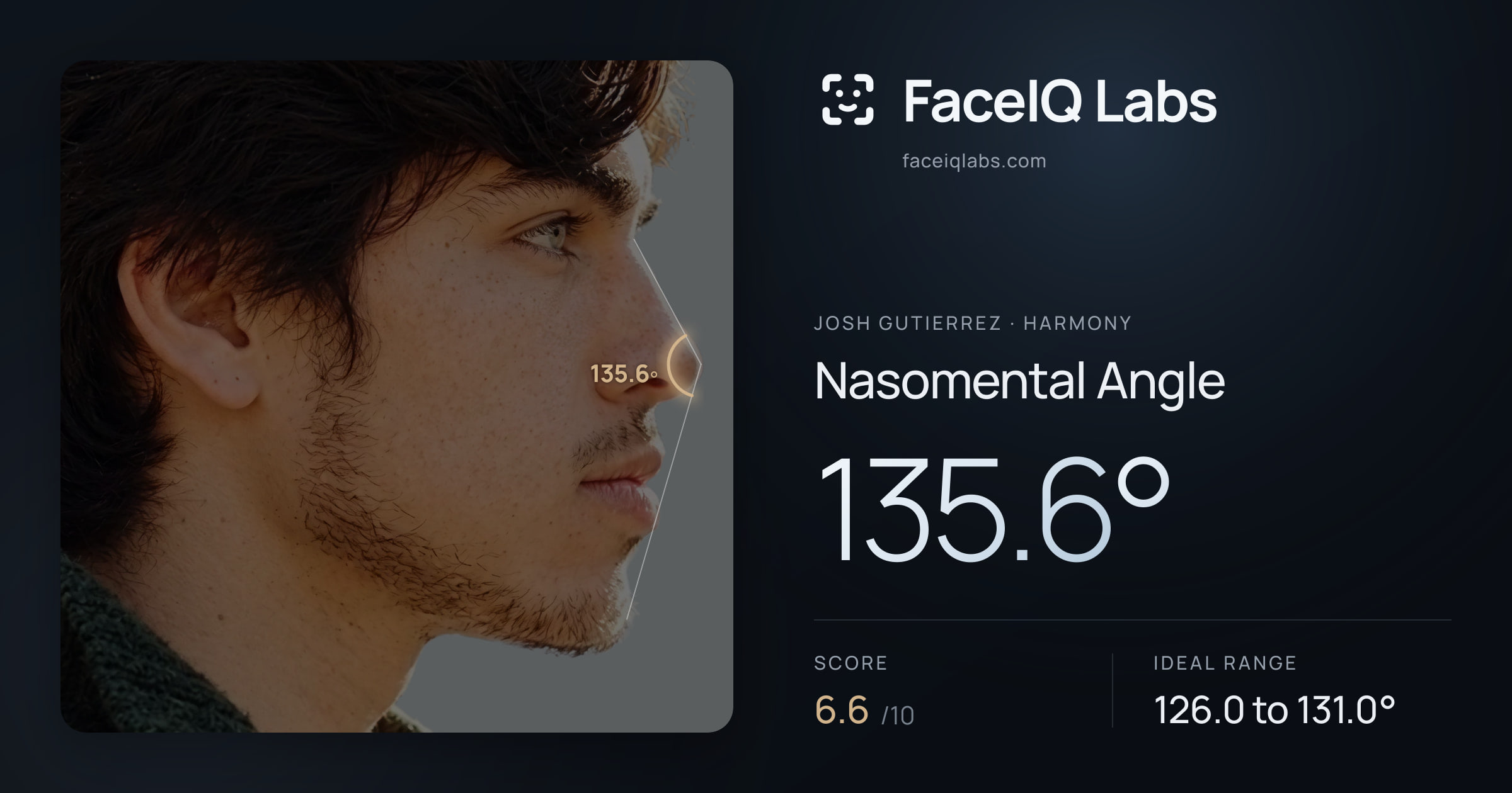 Josh Gutierrez Nasomental Angle: 135.6°, drawn on the photo