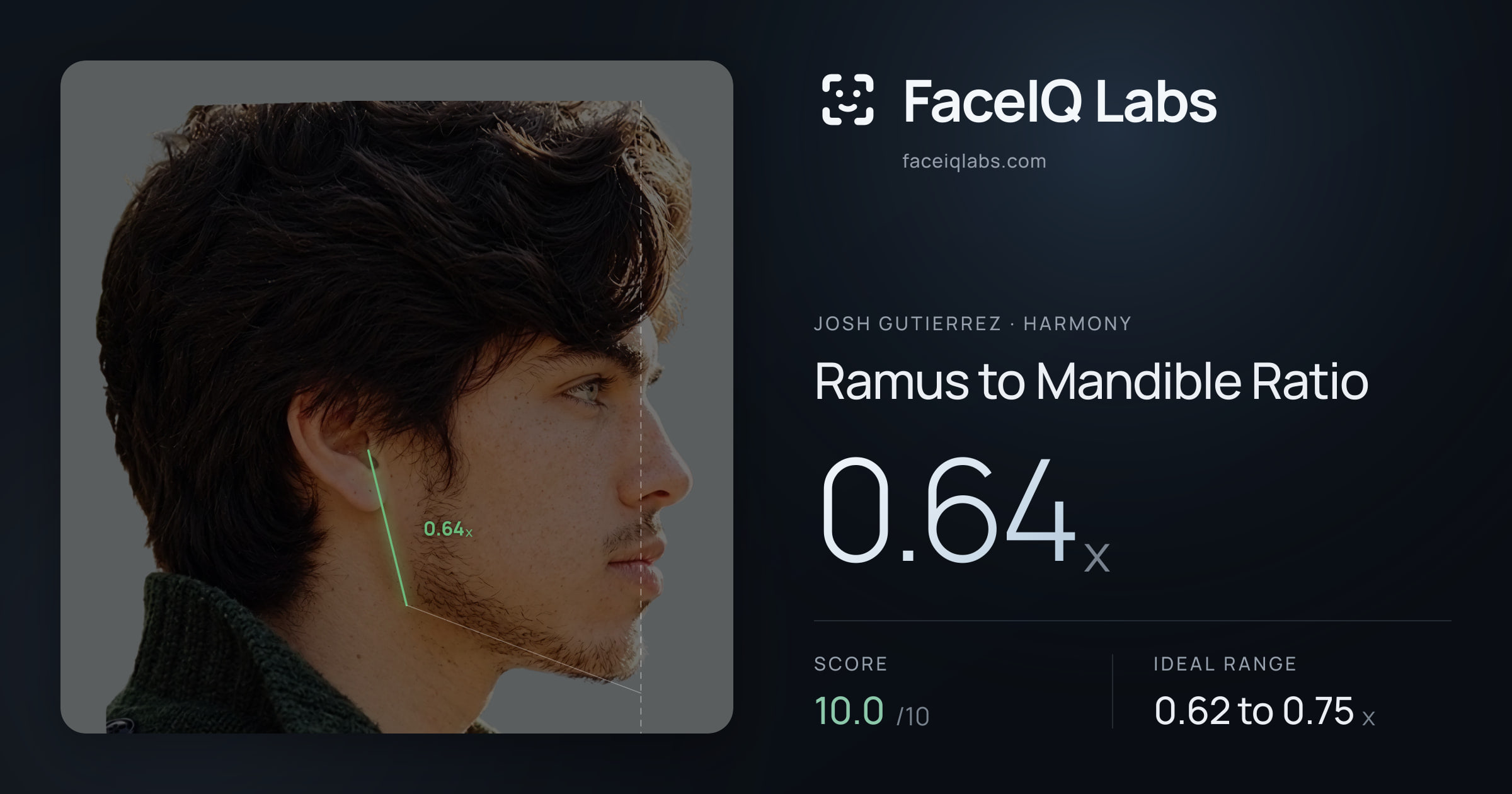 Josh Gutierrez Ramus to Mandible Ratio: 0.64x, drawn on the photo
