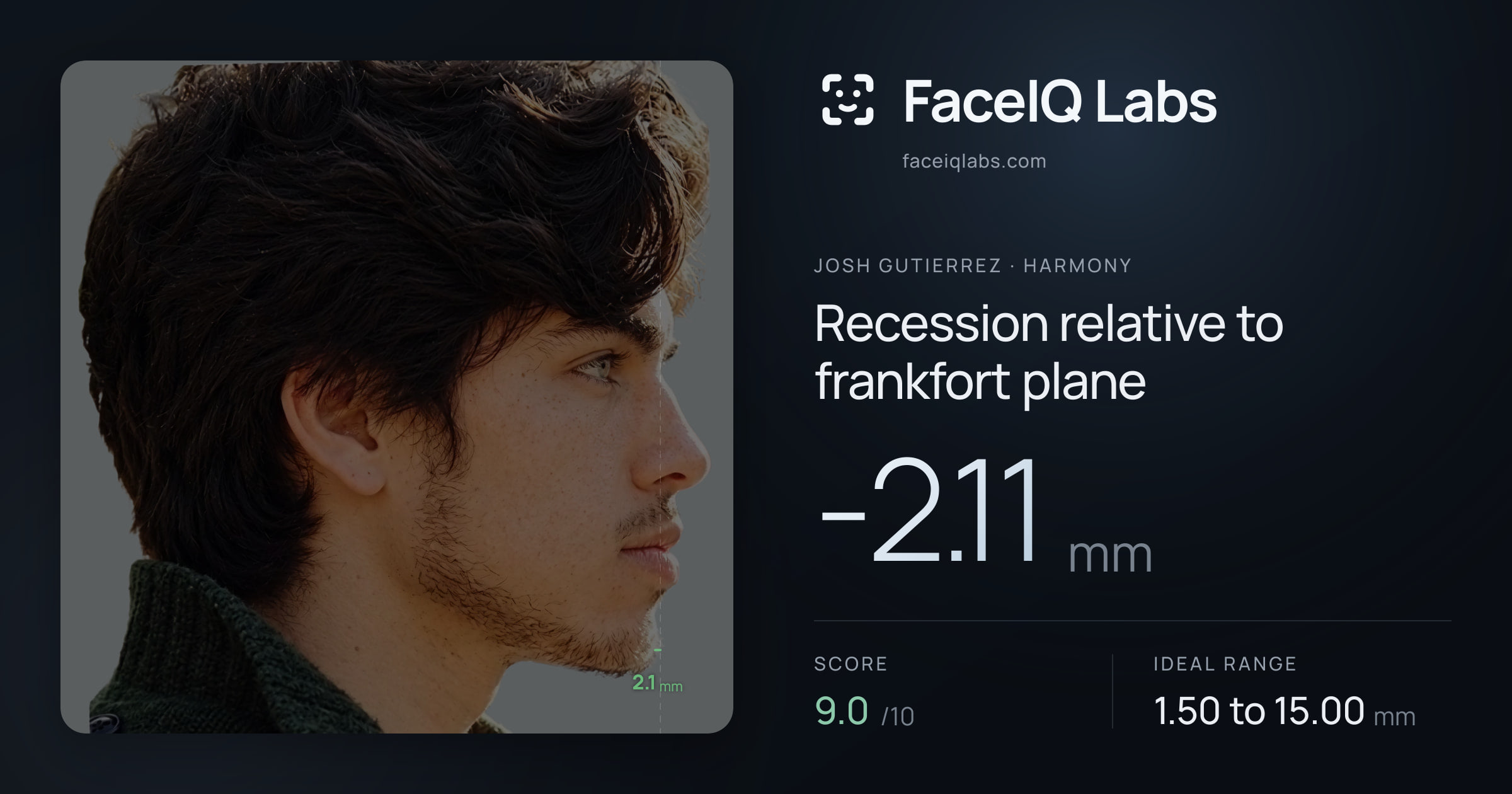 Josh Gutierrez Recession relative to frankfort plane: -2.11mm, drawn on the photo
