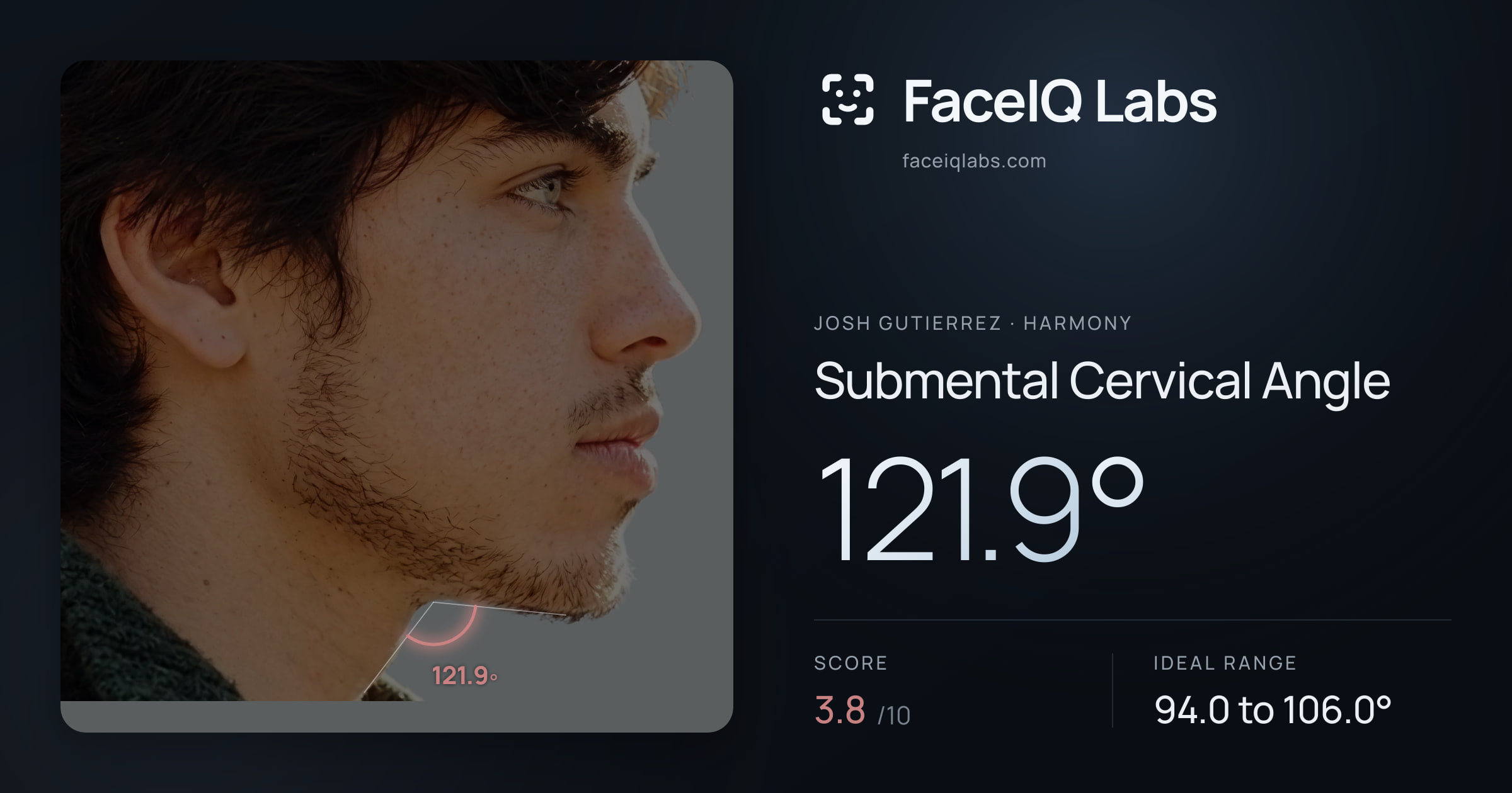 Josh Gutierrez Submental Cervical Angle: 121.9°, drawn on the photo