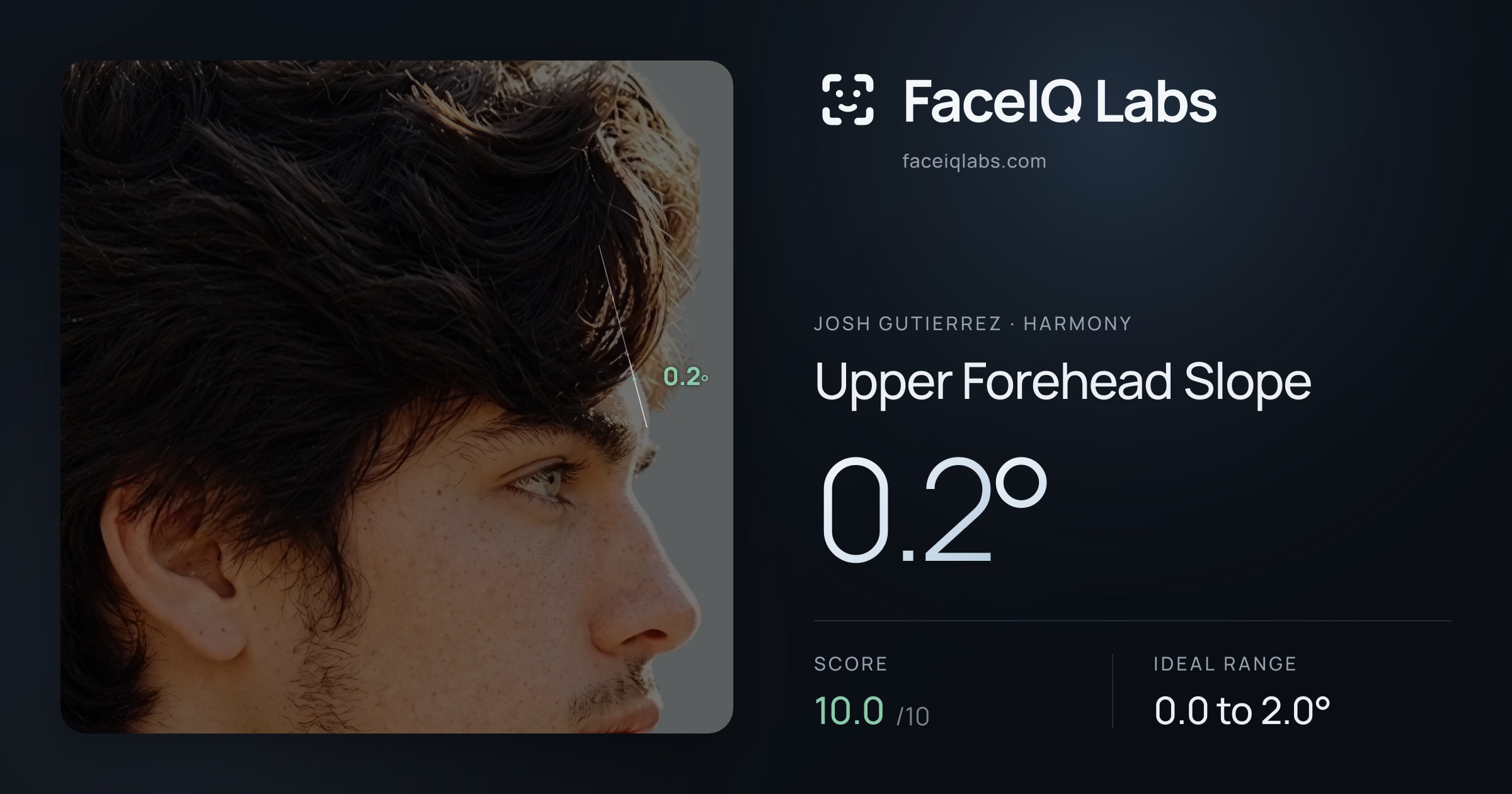 Josh Gutierrez Upper Forehead Slope: 0.2°, drawn on the photo