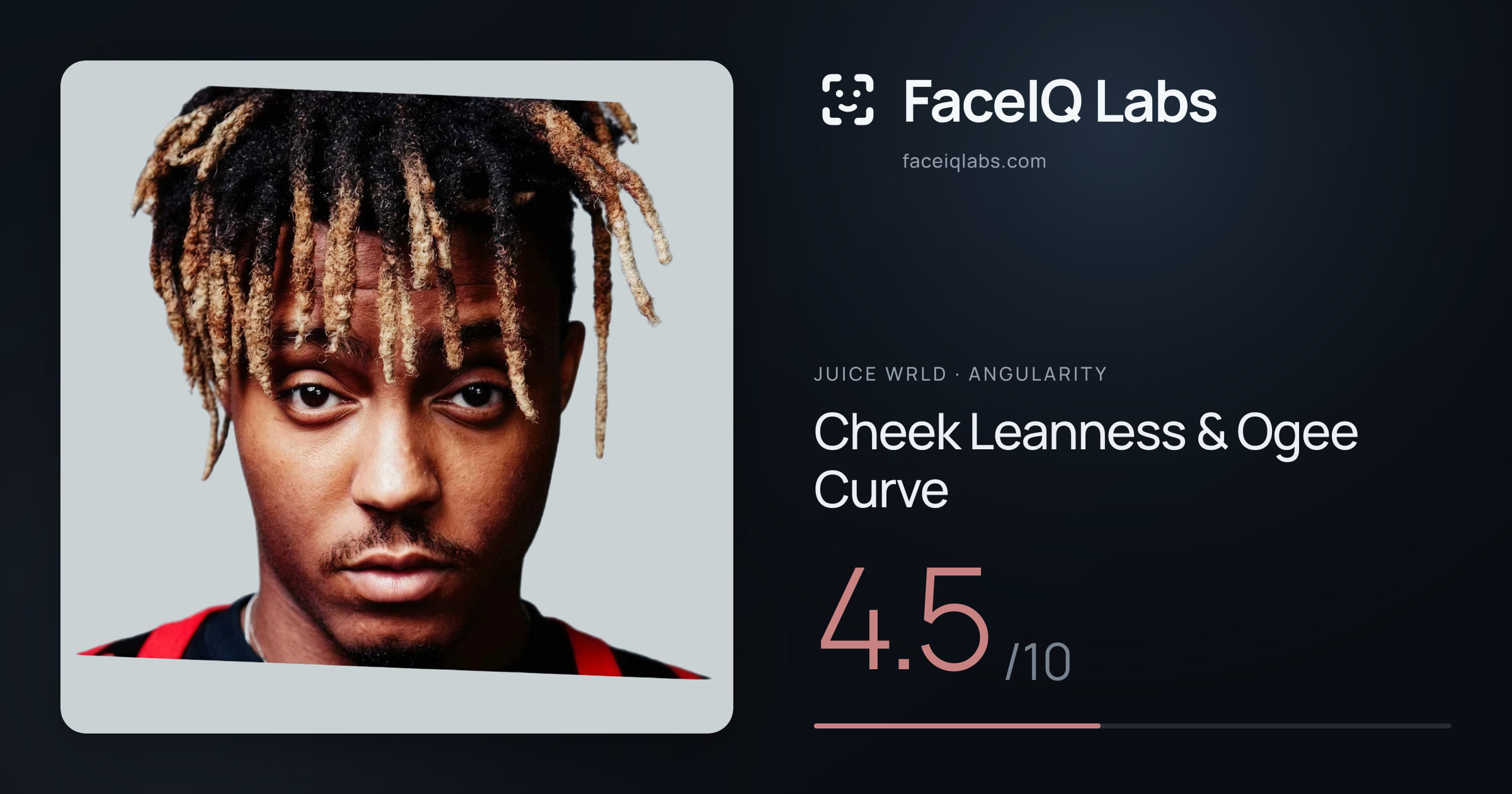 Juice WRLD Cheek Leanness & Ogee Curve: 4.5/10, drawn on the photo