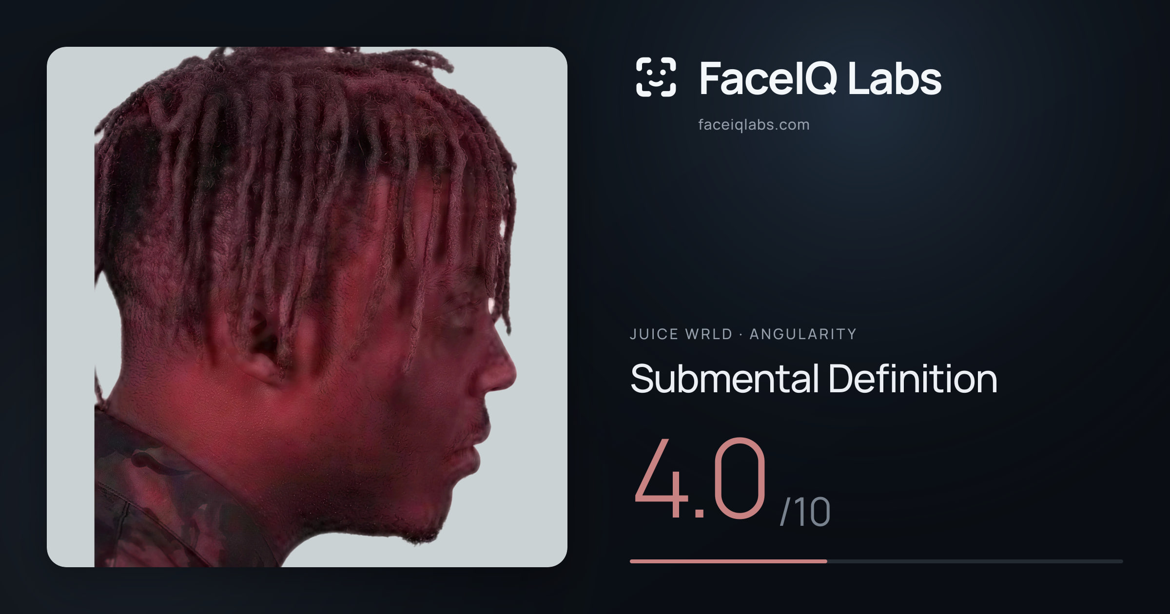 Juice WRLD Submental Definition: 4.0/10, drawn on the photo