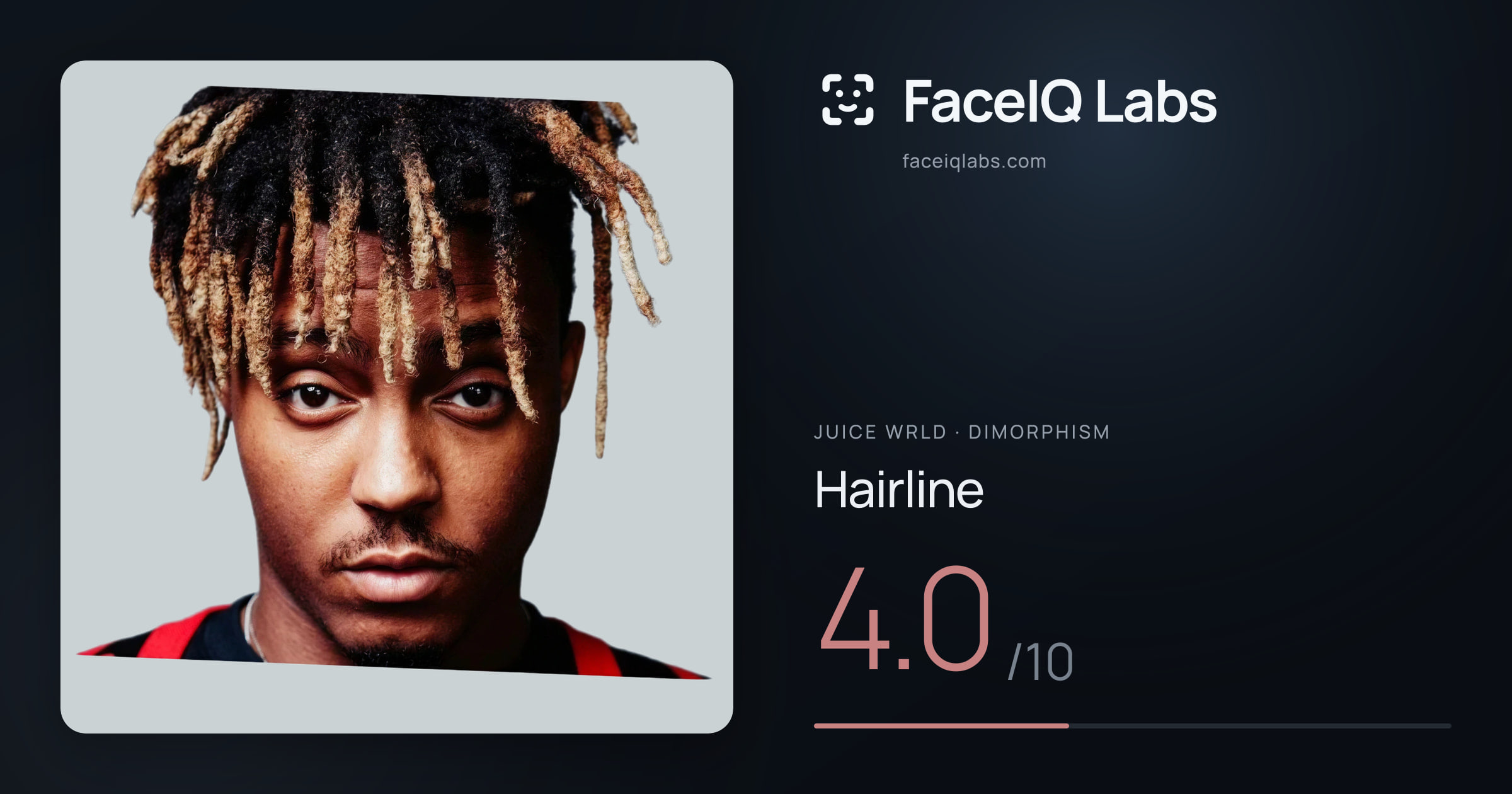 Juice WRLD Hairline: 4.0/10, drawn on the photo