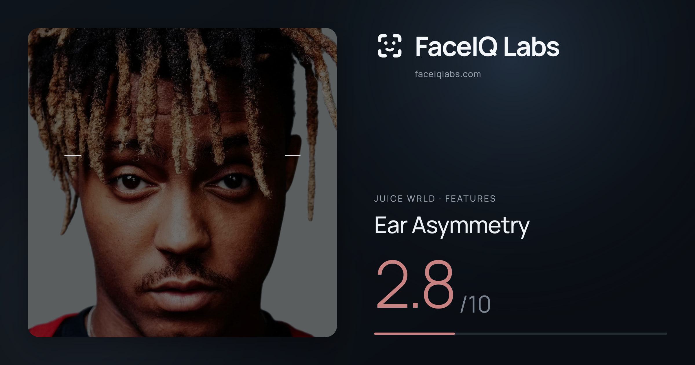 Juice WRLD Ear Asymmetry: 2.8/10, drawn on the photo