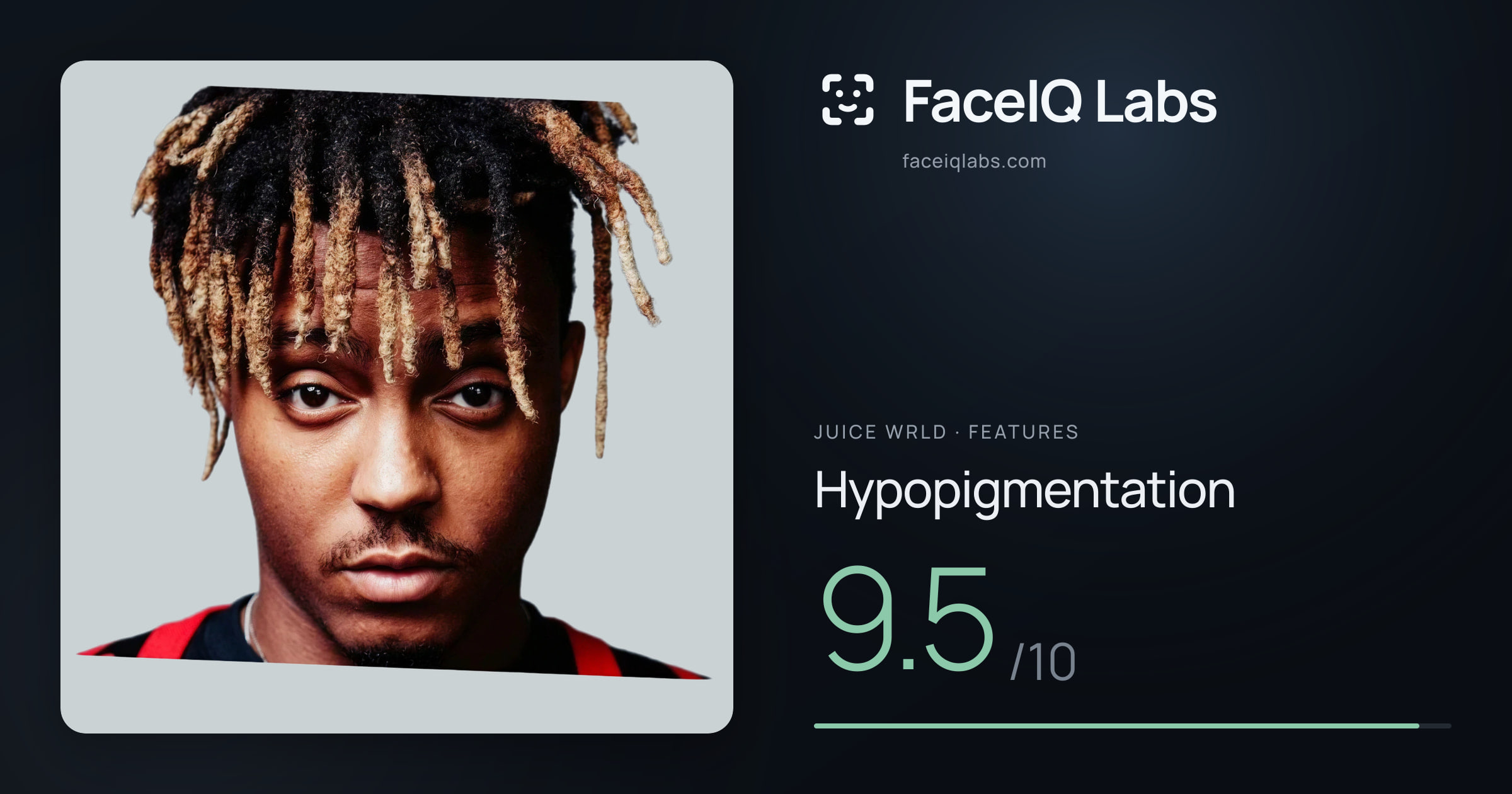 Juice WRLD Hypopigmentation: 9.5/10, drawn on the photo