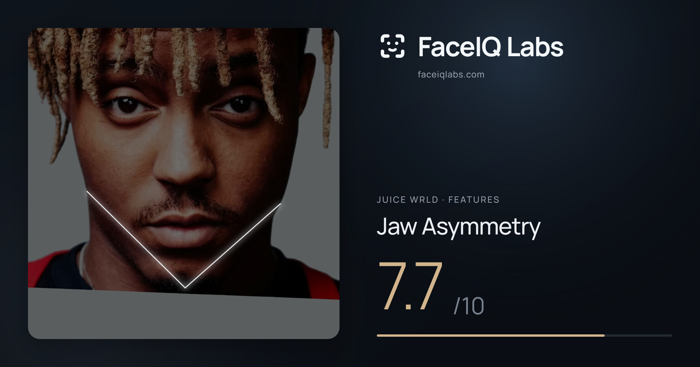 Juice WRLD Jaw Asymmetry: 7.7/10, drawn on the photo