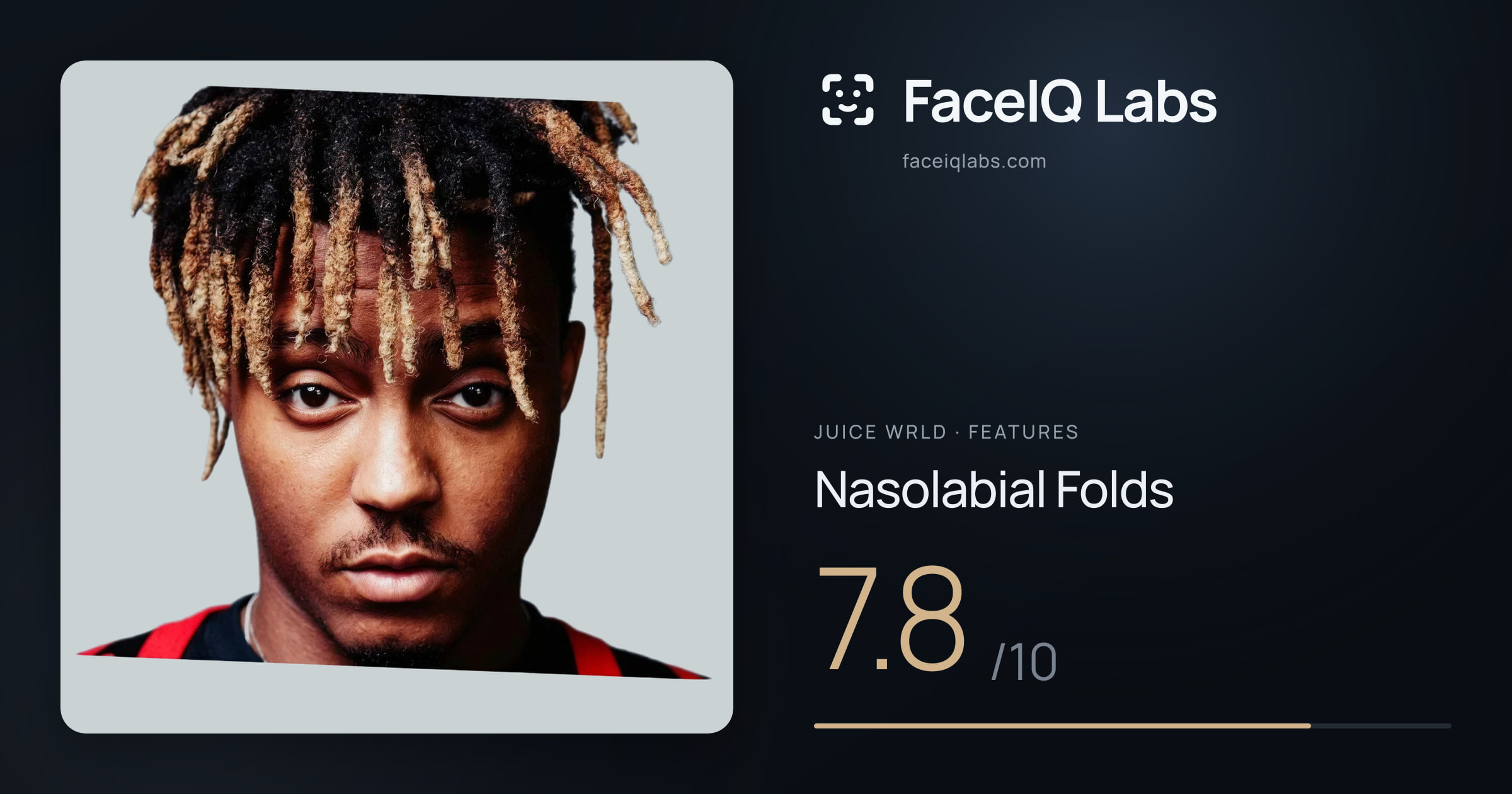Juice WRLD Nasolabial Folds: 7.8/10, drawn on the photo