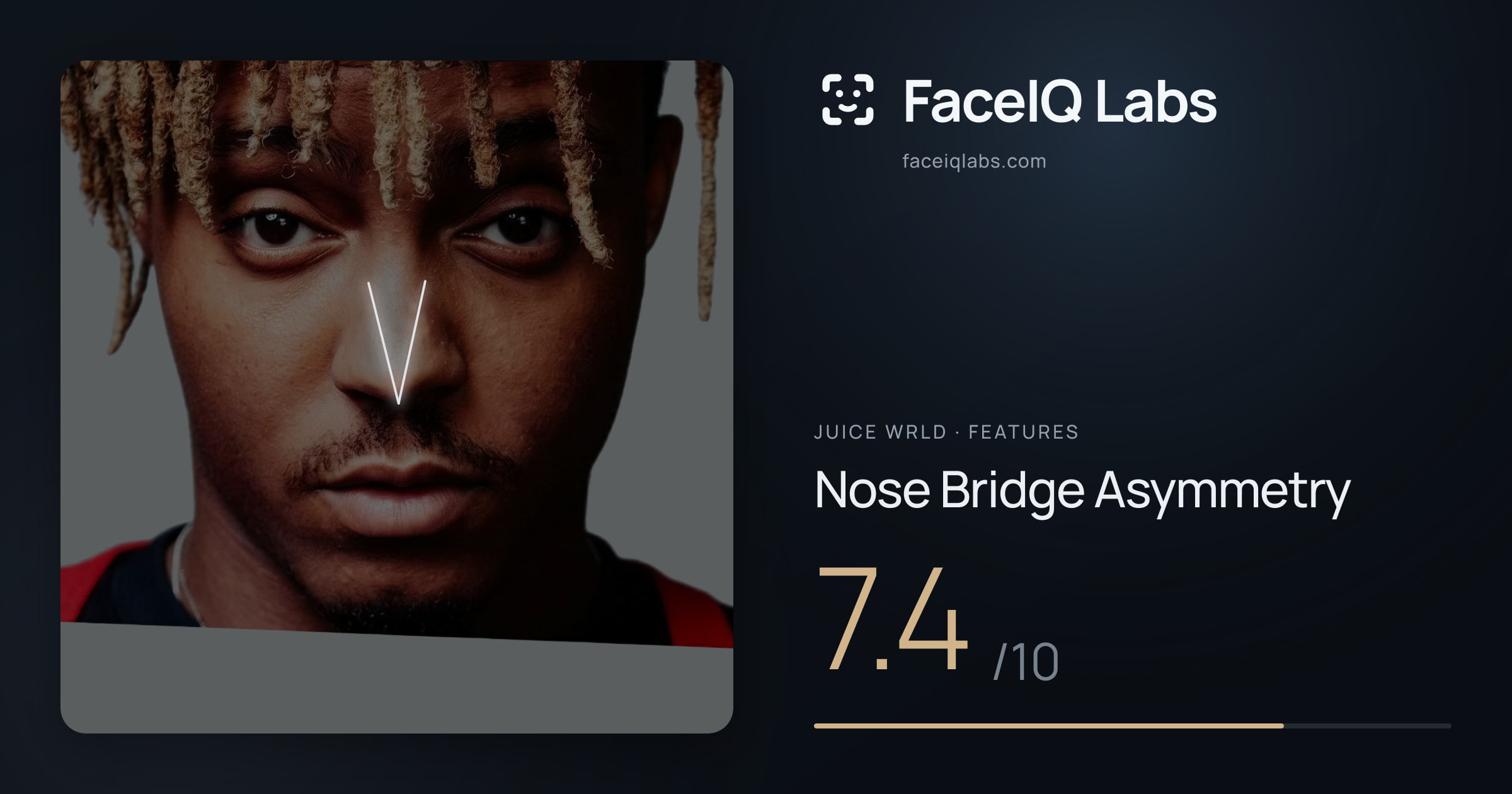 Juice WRLD Nose Bridge Asymmetry: 7.4/10, drawn on the photo