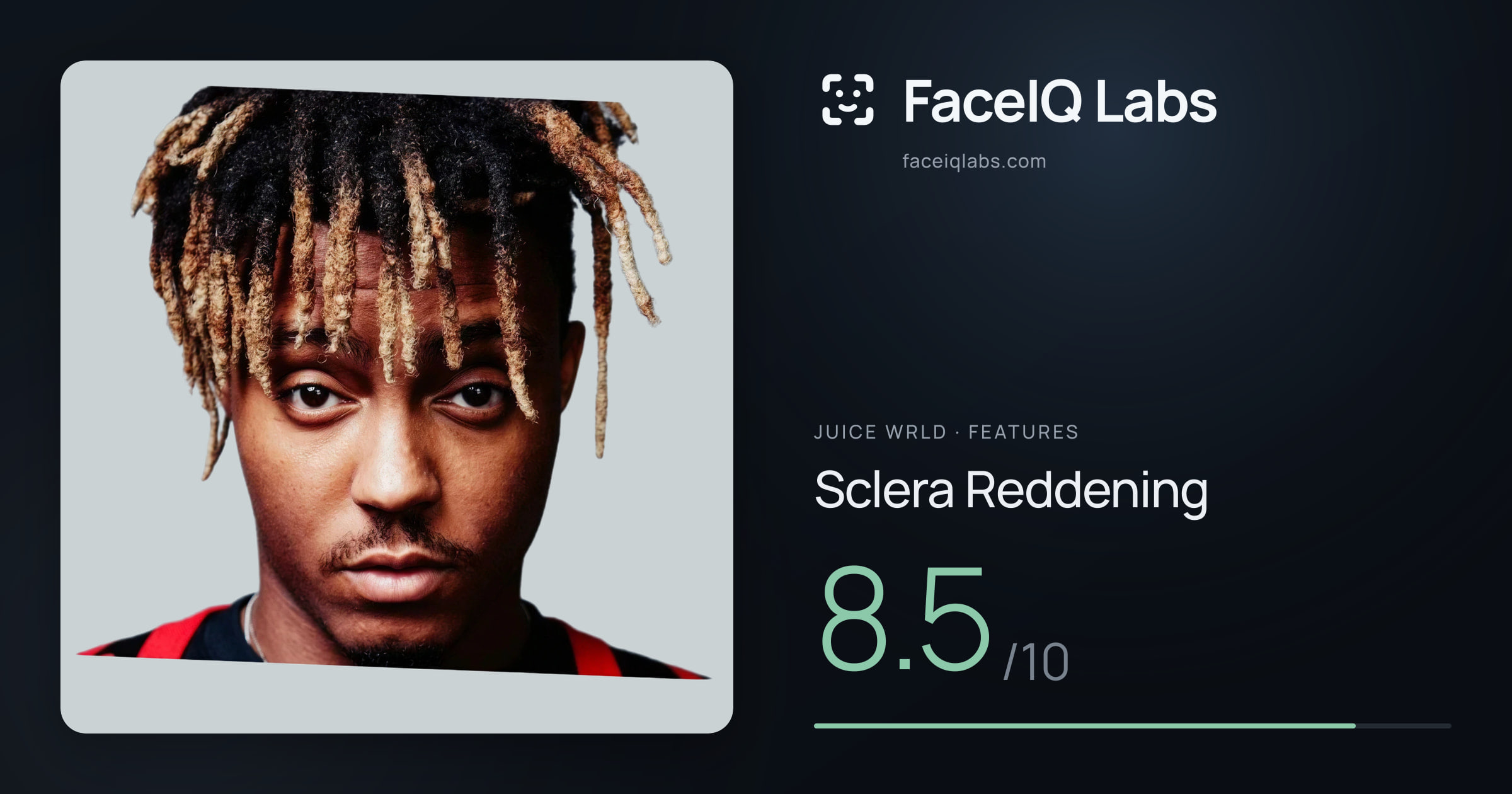 Juice WRLD Sclera Reddening: 8.5/10, drawn on the photo