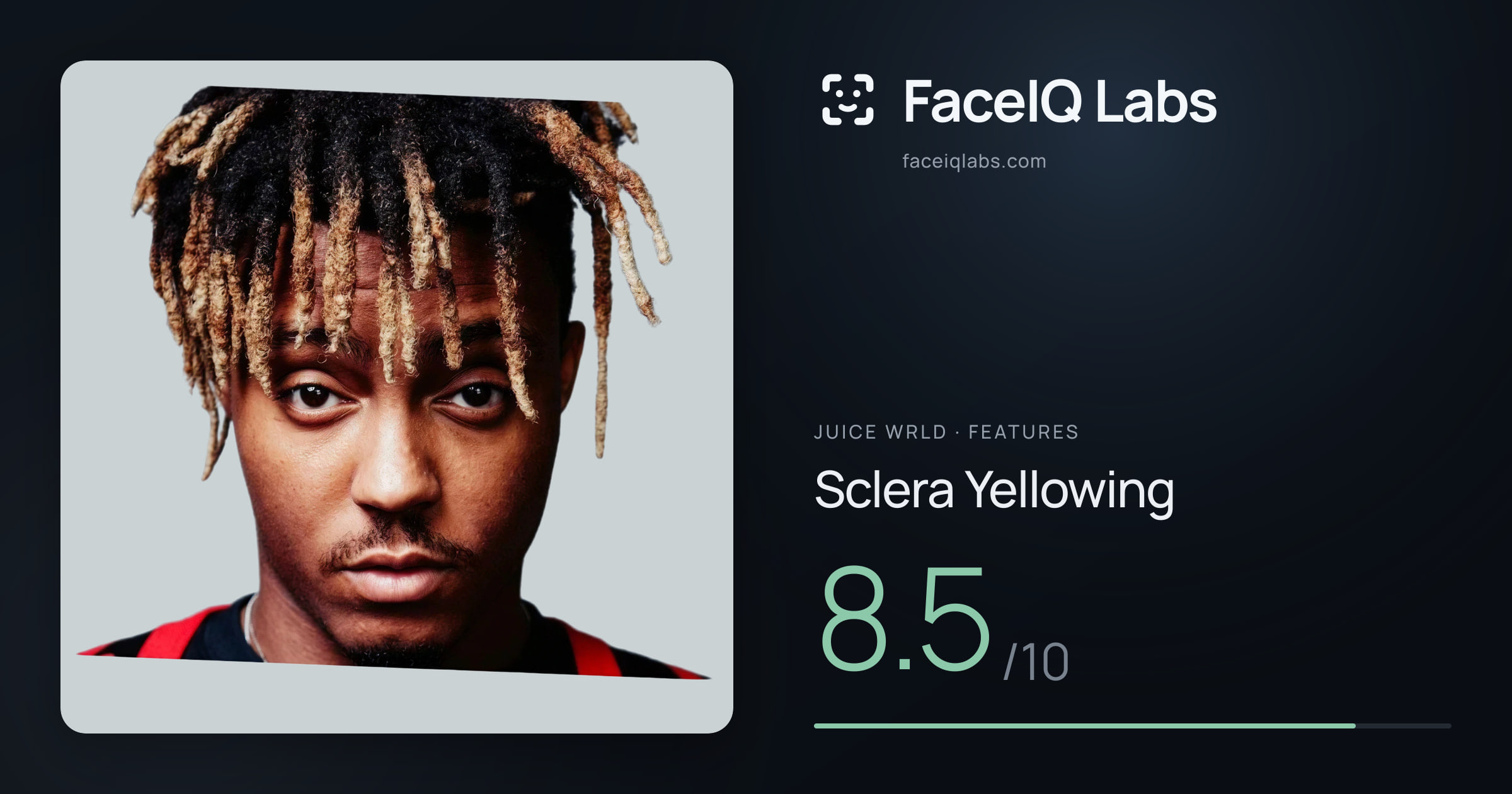 Juice WRLD Sclera Yellowing: 8.5/10, drawn on the photo