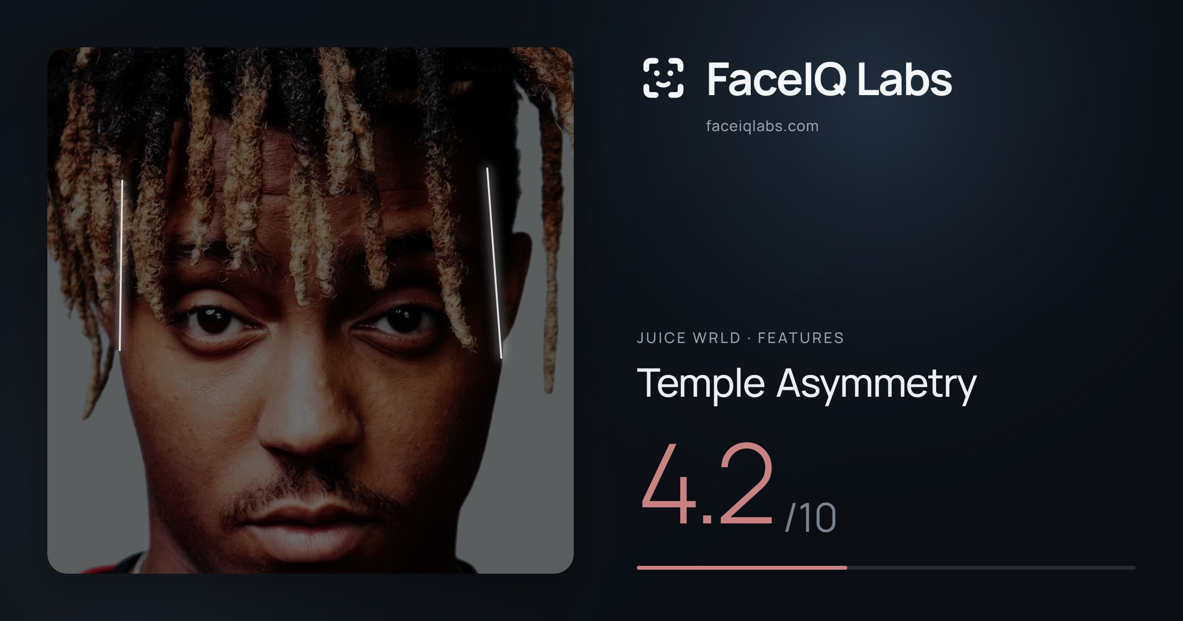 Juice WRLD Temple Asymmetry: 4.2/10, drawn on the photo