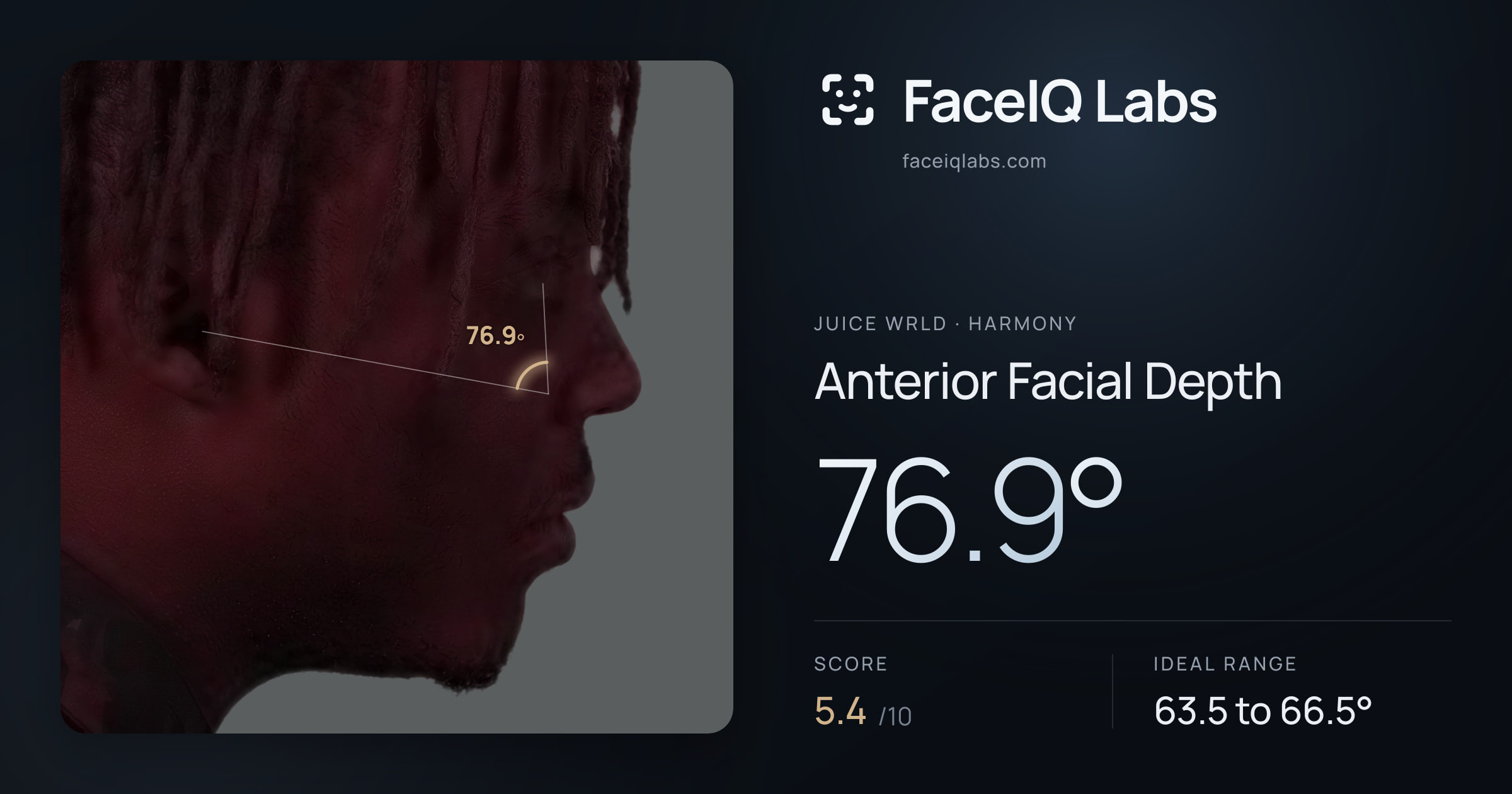 Juice WRLD Anterior Facial Depth: 76.9°, drawn on the photo
