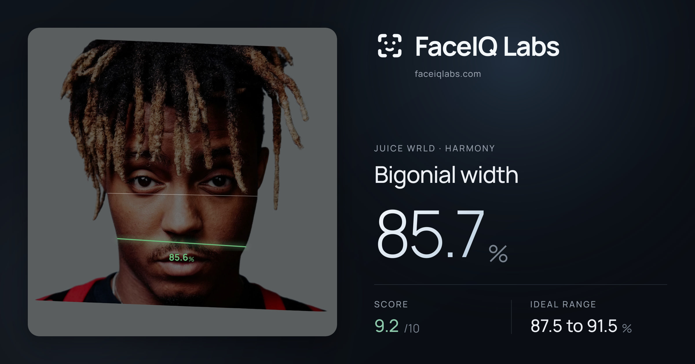 Juice WRLD Bigonial width: 85.7%, drawn on the photo