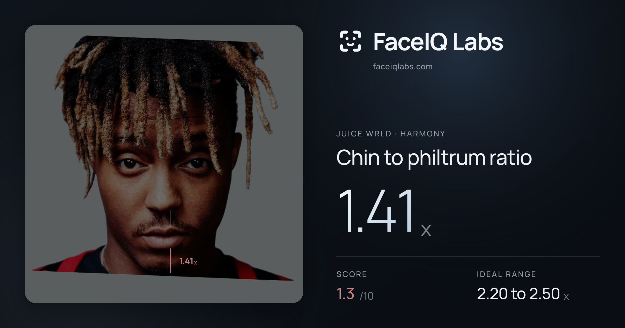Juice WRLD Chin to philtrum ratio: 1.41x, drawn on the photo