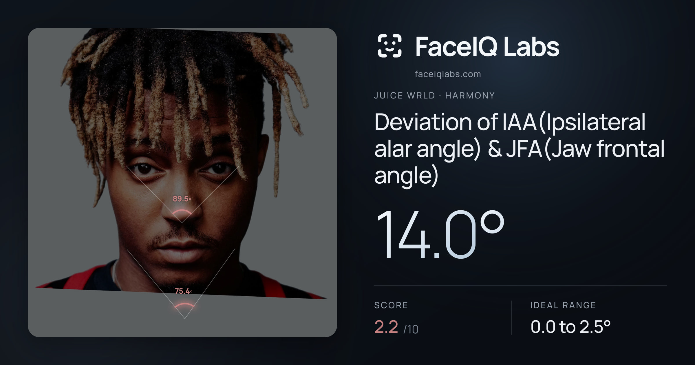 Juice WRLD Deviation of IAA(Ipsilateral alar angle) & JFA(Jaw frontal angle): 14.0°, drawn on the photo