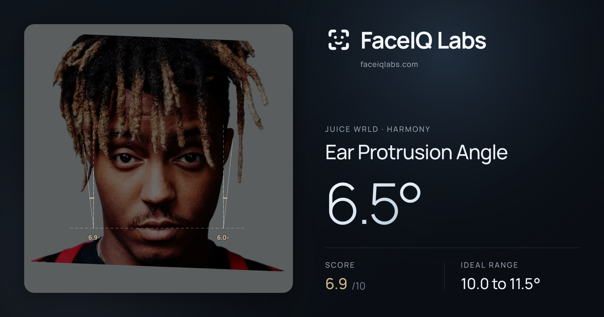 Juice WRLD Ear Protrusion Angle: 6.5°, drawn on the photo