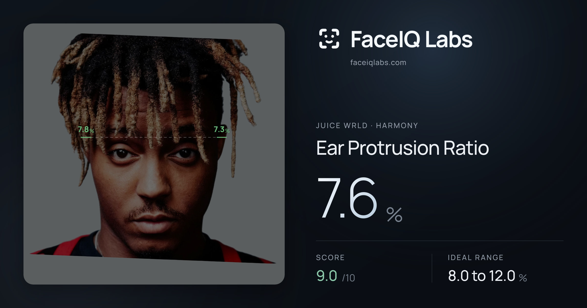 Juice WRLD Ear Protrusion Ratio: 7.6%, drawn on the photo