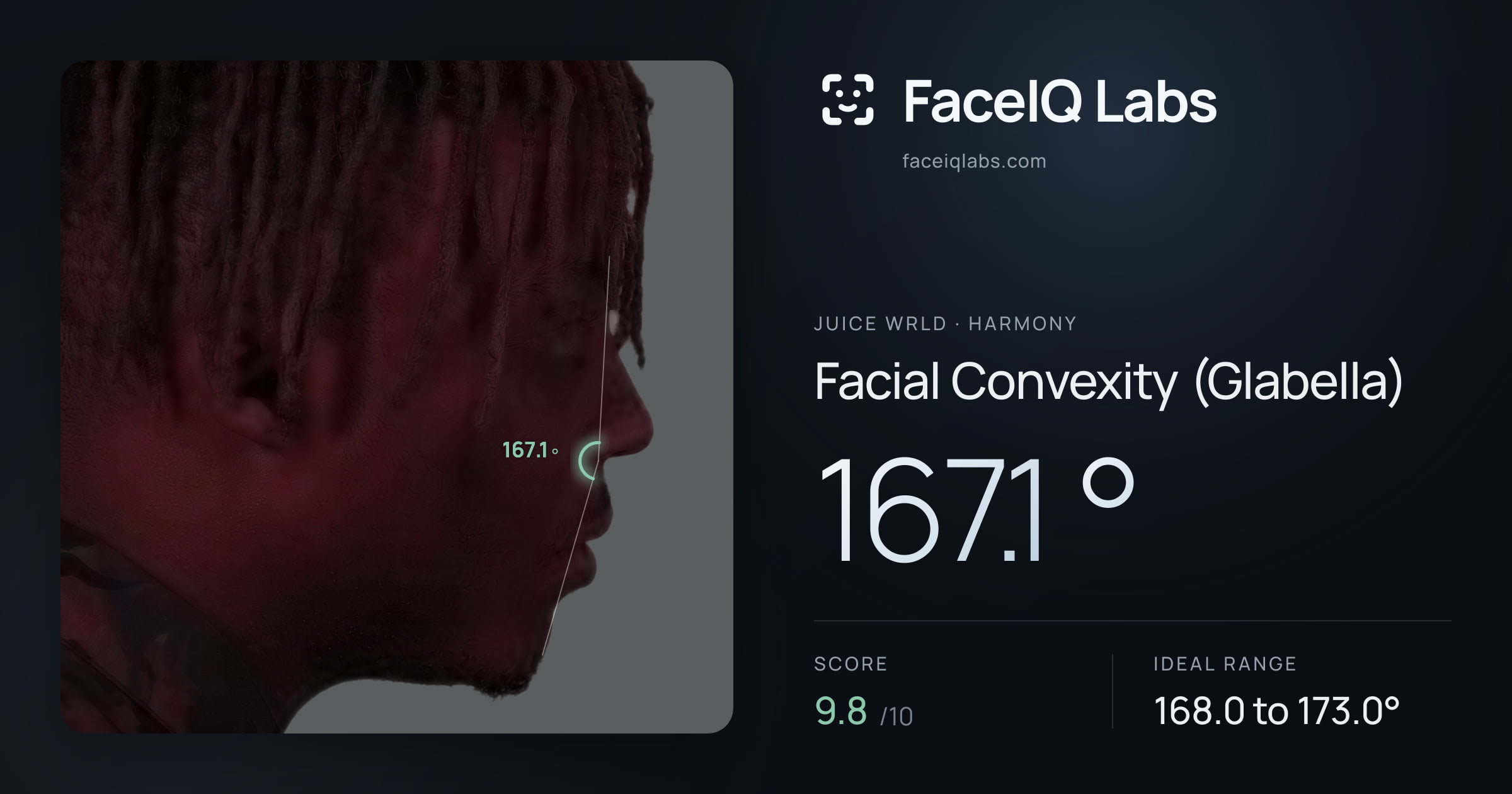 Juice WRLD Facial Convexity (Glabella): 167.1°, drawn on the photo