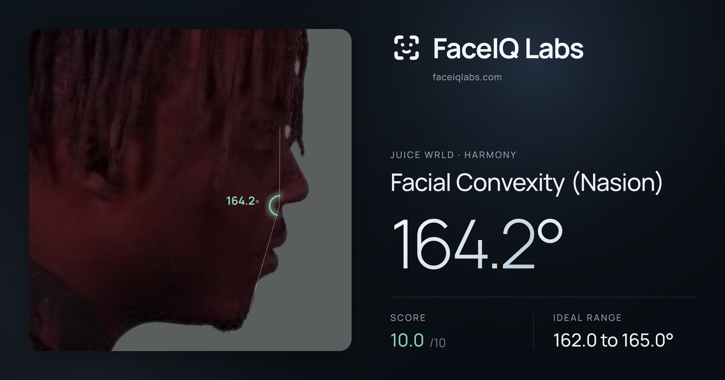 Juice WRLD Facial Convexity (Nasion): 164.2°, drawn on the photo