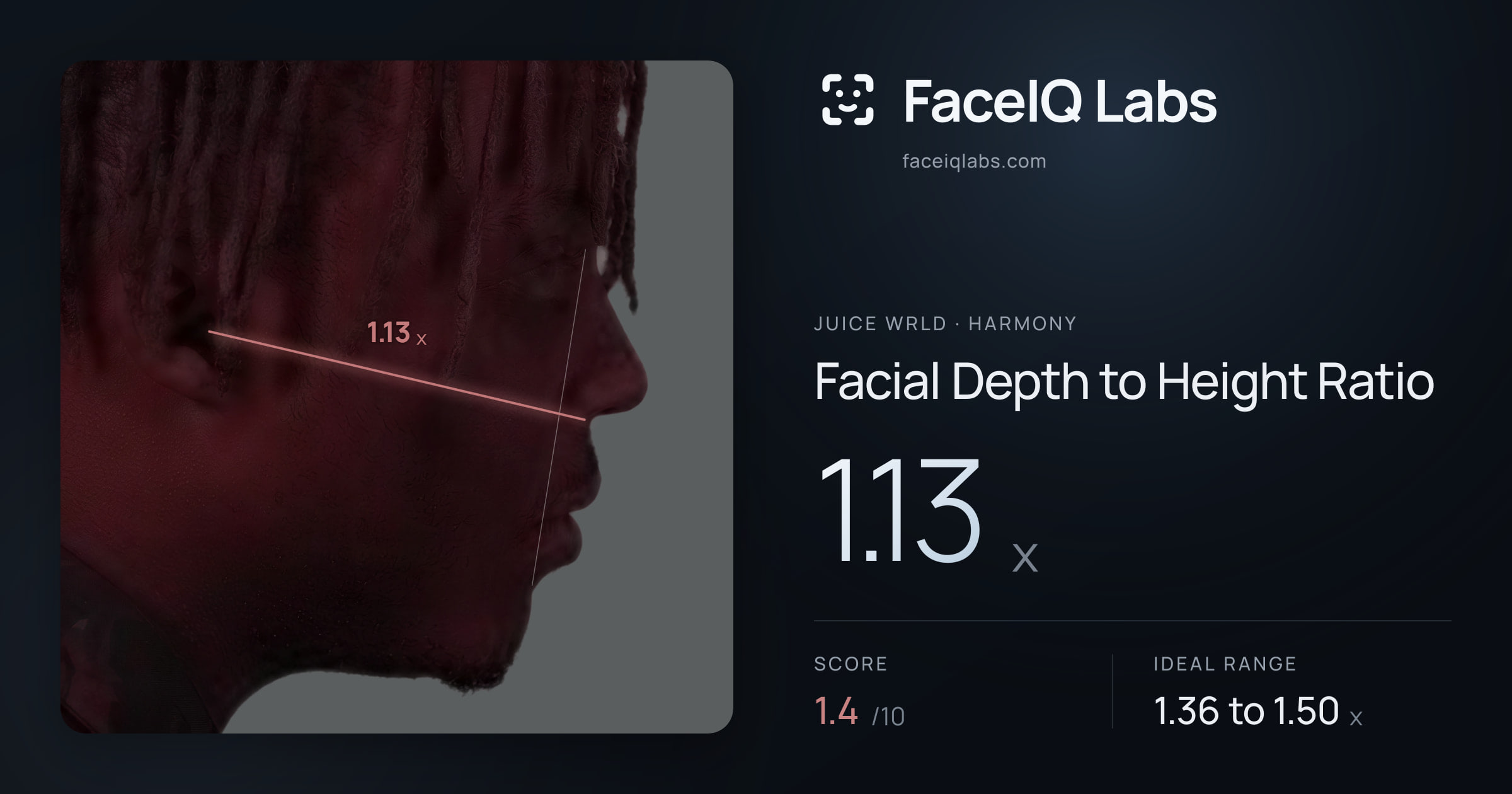Juice WRLD Facial Depth to Height Ratio: 1.13x, drawn on the photo