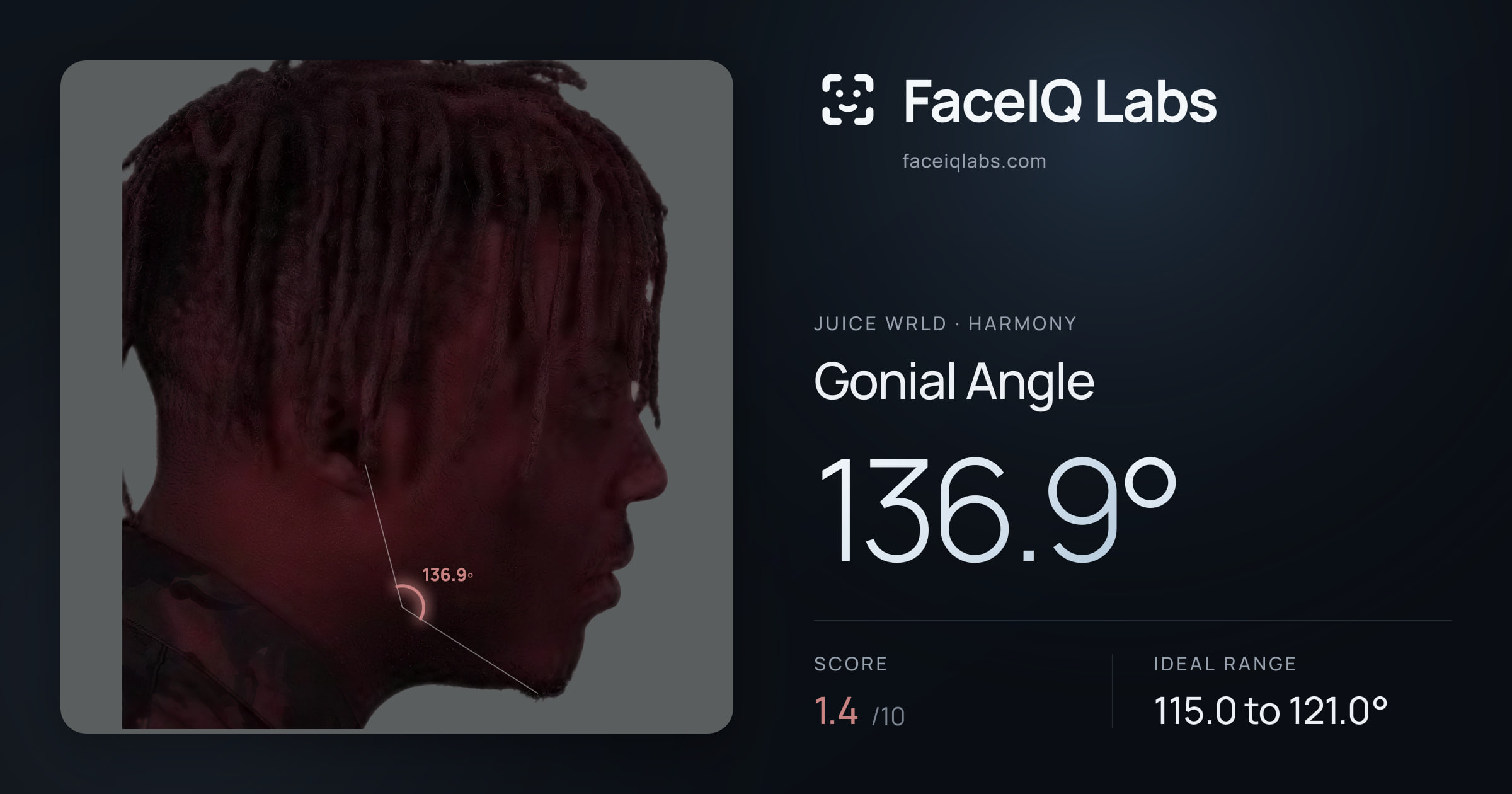Juice WRLD Gonial Angle: 136.9°, drawn on the photo