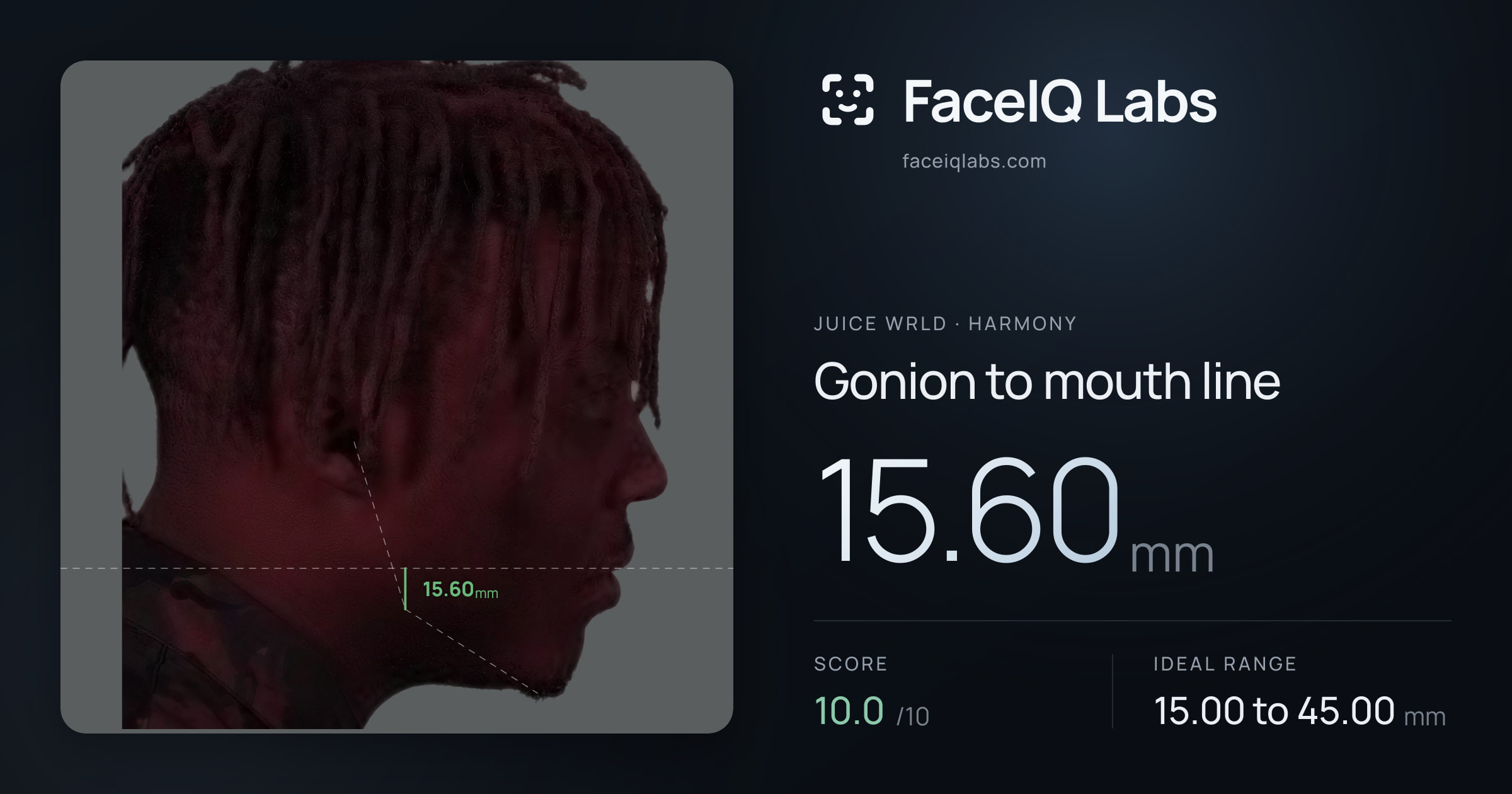 Juice WRLD Gonion to mouth line: 15.60mm, drawn on the photo