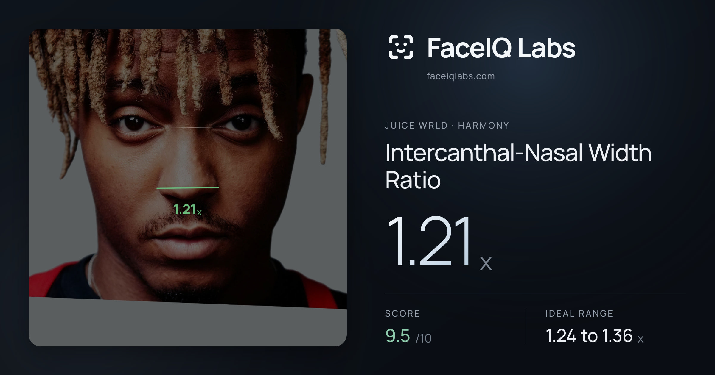 Juice WRLD Intercanthal-Nasal Width Ratio: 1.21x, drawn on the photo