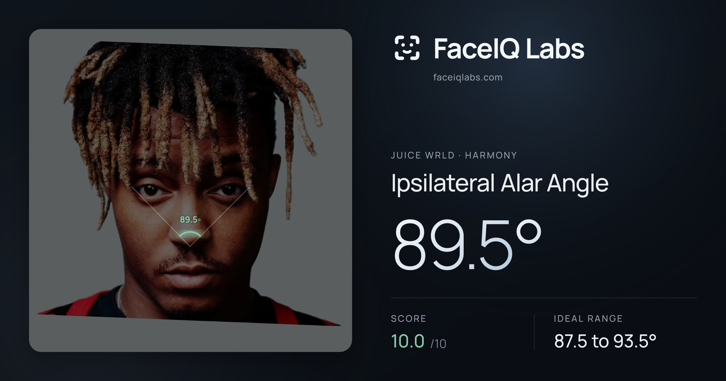 Juice WRLD Ipsilateral Alar Angle: 89.5°, drawn on the photo