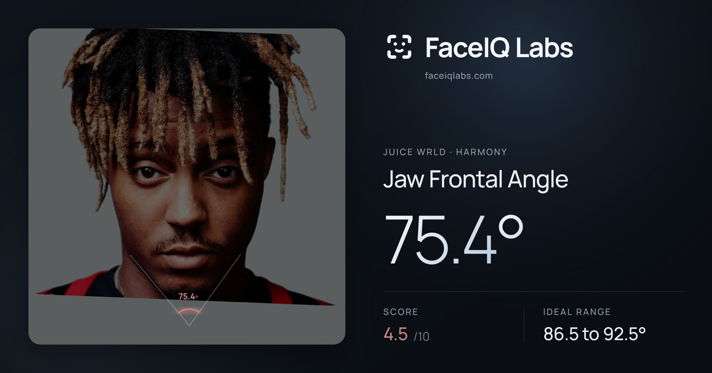 Juice WRLD Jaw Frontal Angle: 75.4°, drawn on the photo