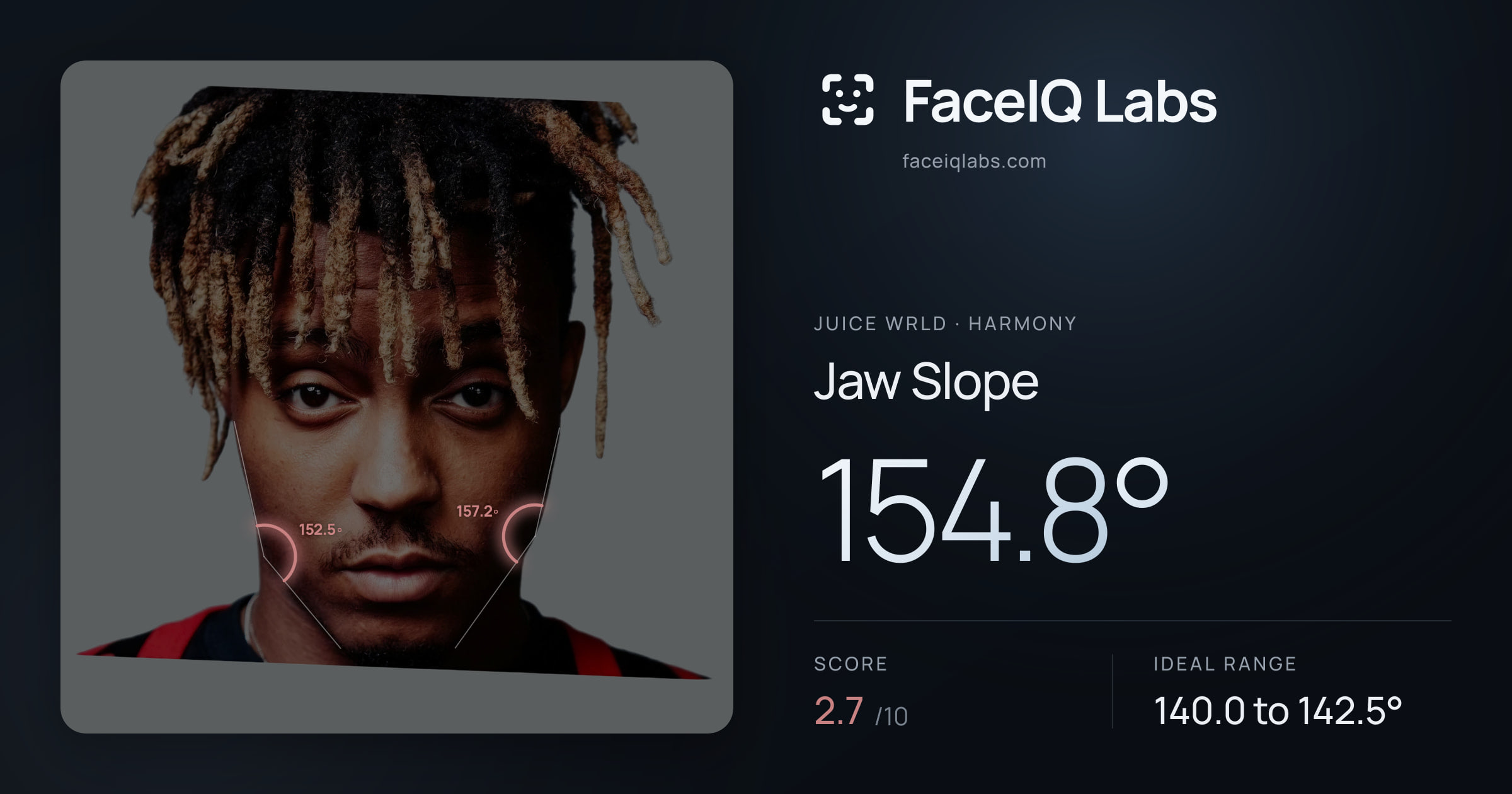 Juice WRLD Jaw Slope: 154.8°, drawn on the photo