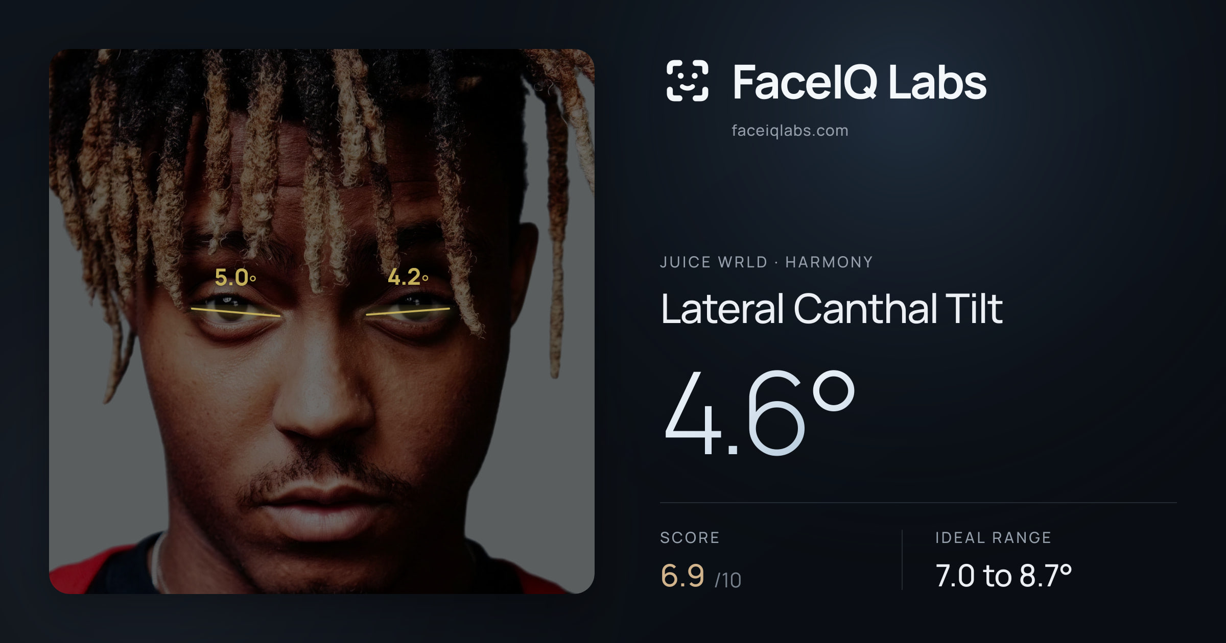 Juice WRLD Lateral Canthal Tilt: 4.6°, drawn on the photo